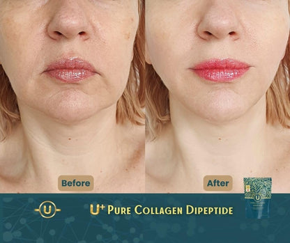 U+ Pure Collagen Dipeptide Supplement - Advanced Hydrolyzed Collagen Powder for Skin, Hair U+ Pure CollagenUS supplements