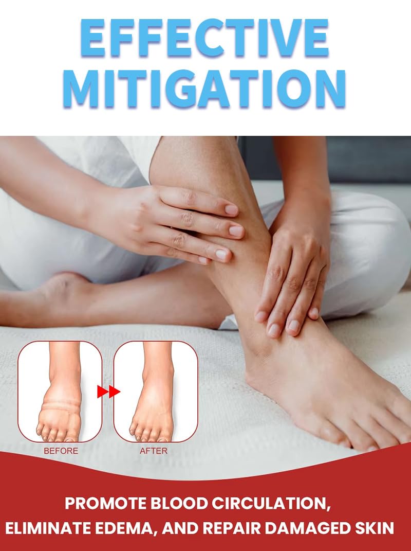Leg Slimming Massage Cream | Soothing Swelling, Tightening Skin, Auxiliary Care for Reducing Edema （2 Pieces） bobojujuAu supplements