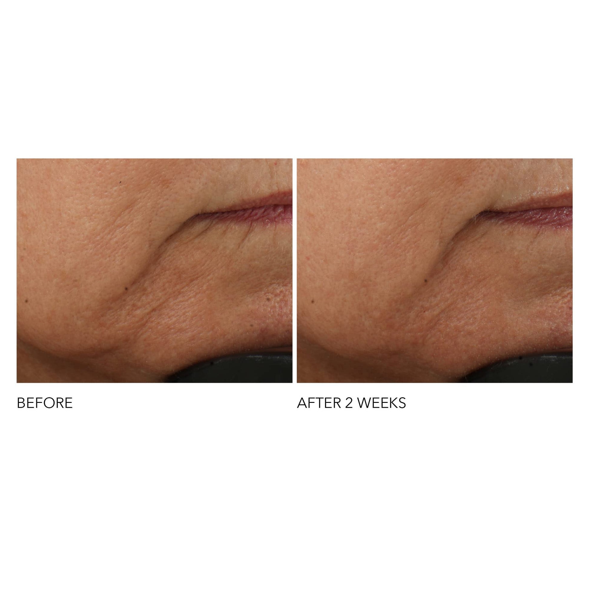 Dr Dennis Gross Advanced Retinol + Ferulic Intense Wrinkle Cream | Intensely Hydrating to Visibly Transform Skin and Repair the Moisture Barrier | 2 oz Dr Dennis GrossAu supplements