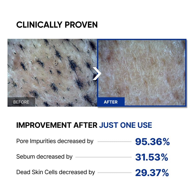 SAYNID MICROBIOME RENEWING CREAM MASK TRIAL KIT, Wash-off Cream, Soft Exfoliating Face Scrub Dead Skin Cells | 4.5g/0.15oz (3EA) SAYNIDAu supplements