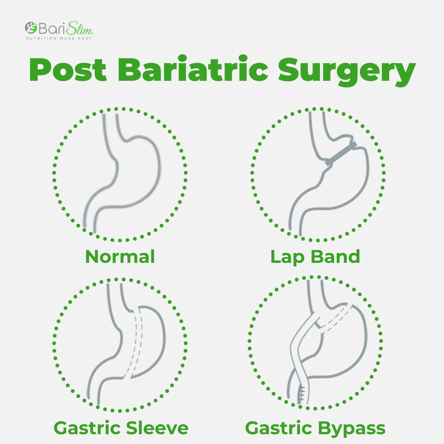 BariSlim Bariatric Calcium Citrate Plus Powder - Formulated for Patients After Weight Loss BariSlimUS supplements