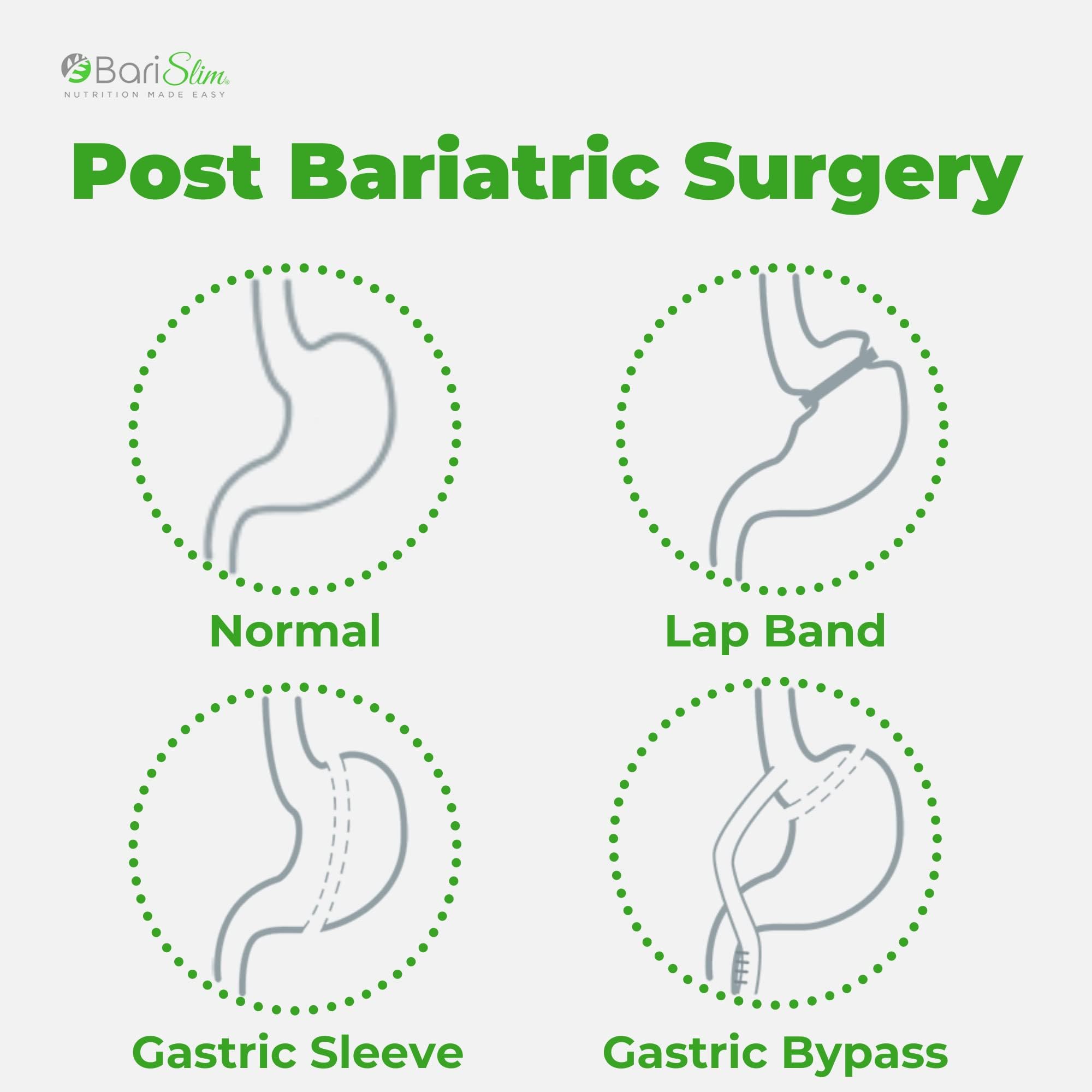 BariSlim Bariatric Calcium Citrate Plus Powder - Formulated for Patients After Weight Loss BariSlimAu supplements