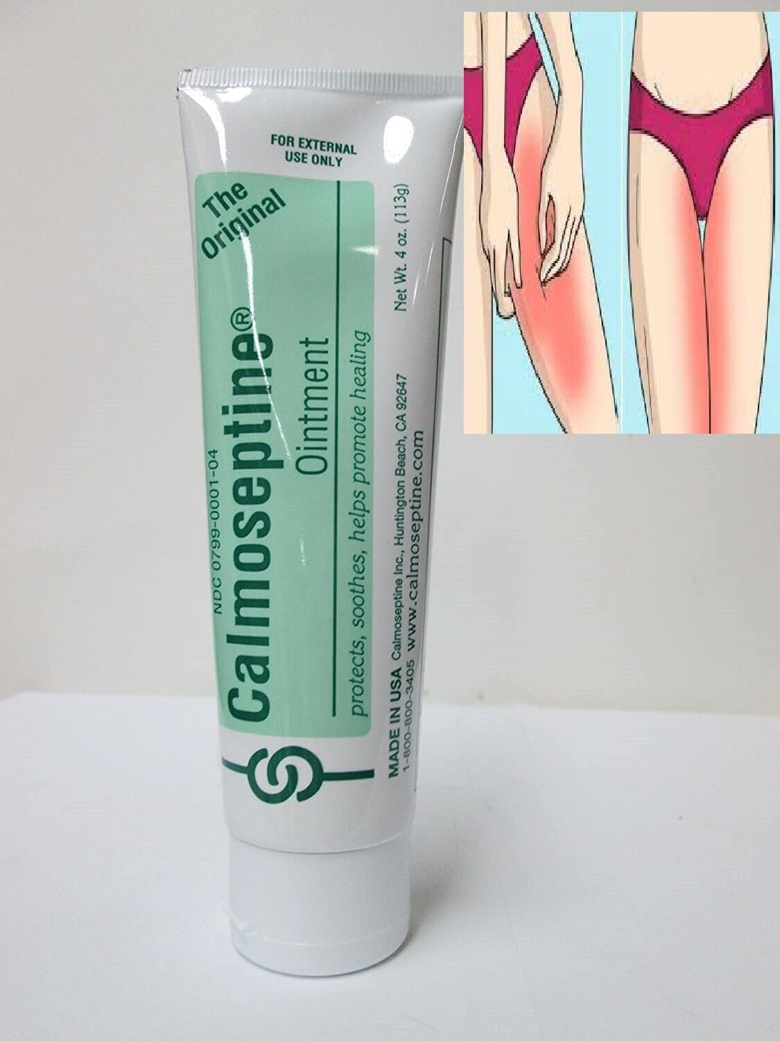 Crema para Infecciones Vaginales Elimina hongos Picazon Irritación Pomada Vagina GenericAu supplements