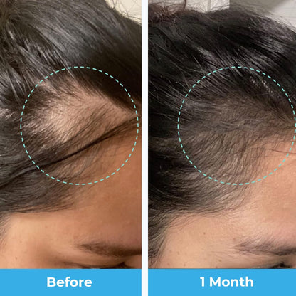 Baby Blues Postpartum Hair Loss Vitamins - Passion Fruit Gummies with Biotin, Collagen, & Folate Baby BluesUS supplements