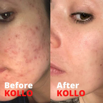 Kollo Premium Marine Collagen Liquid, 10,000 mg - Essential Proteins Collagen Peptides KolloUS supplements