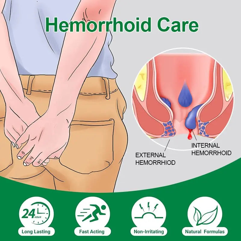 vamy Hemorrhoid Ointment (2 x 20g Tubes), 40g - Maximum Strength Formula for Hemorrhoidal Fast Relief, Soothes Itching, Burning & Discomfort vamyAu supplements