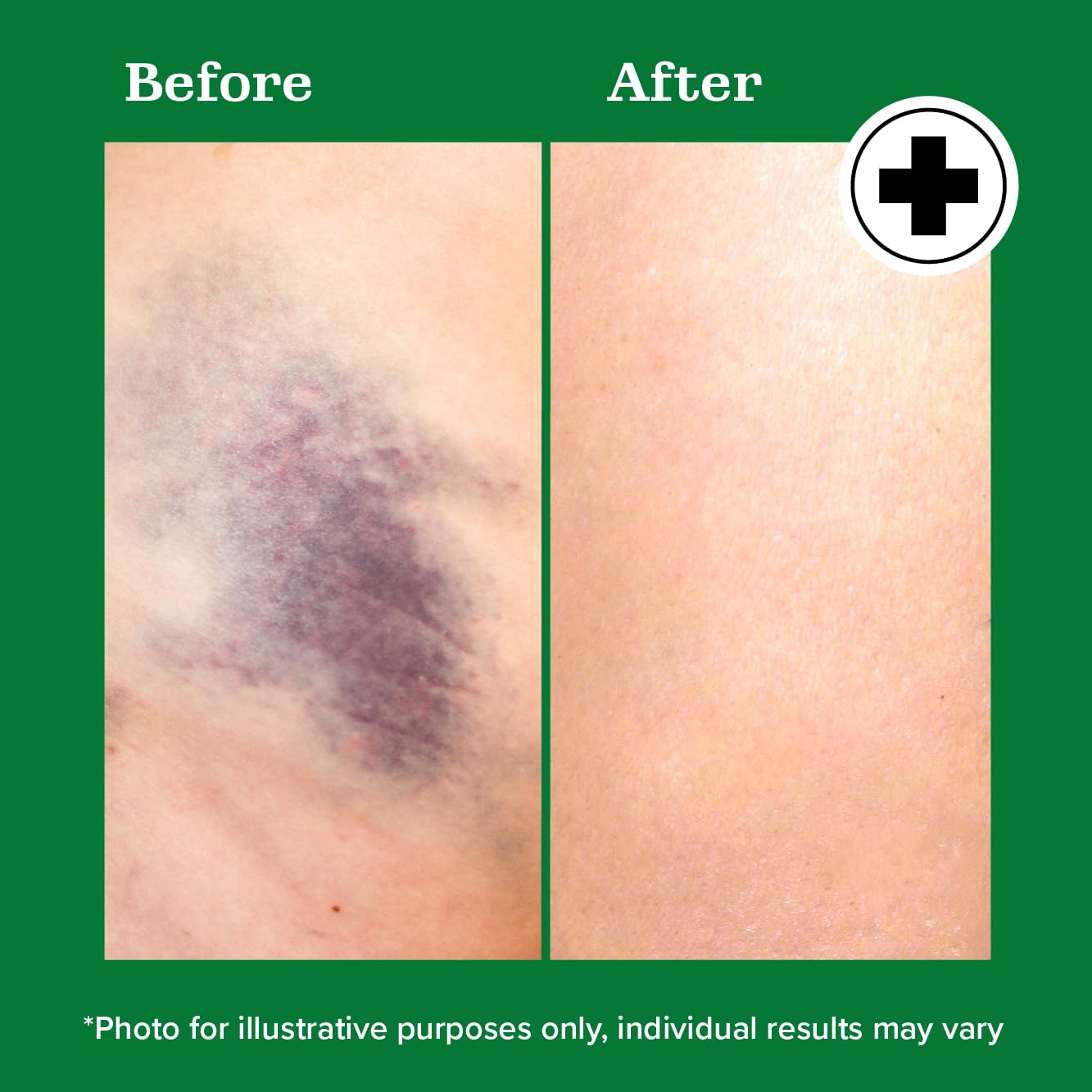 Miracle Plus Arnica Bruise Relief Gel + Magnesium Leg Relief Cream Bundle Miracle PlusAu supplements