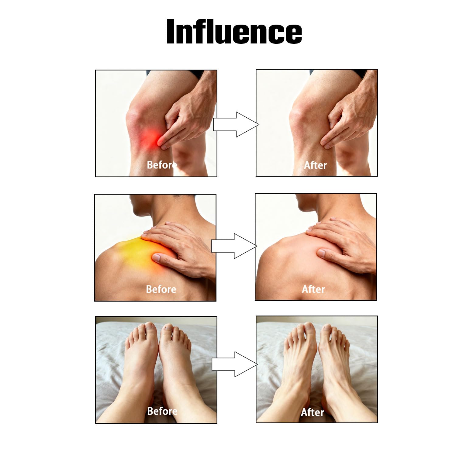 Capsaicin Nerex Relief Cream with Arnica, Menthol, MSM and Glucosamine for Body Joint Areas, Feet, Hands, Legs, Muscles, Joints, and Waist, 100g (2PACKS) bigyuanAu supplements