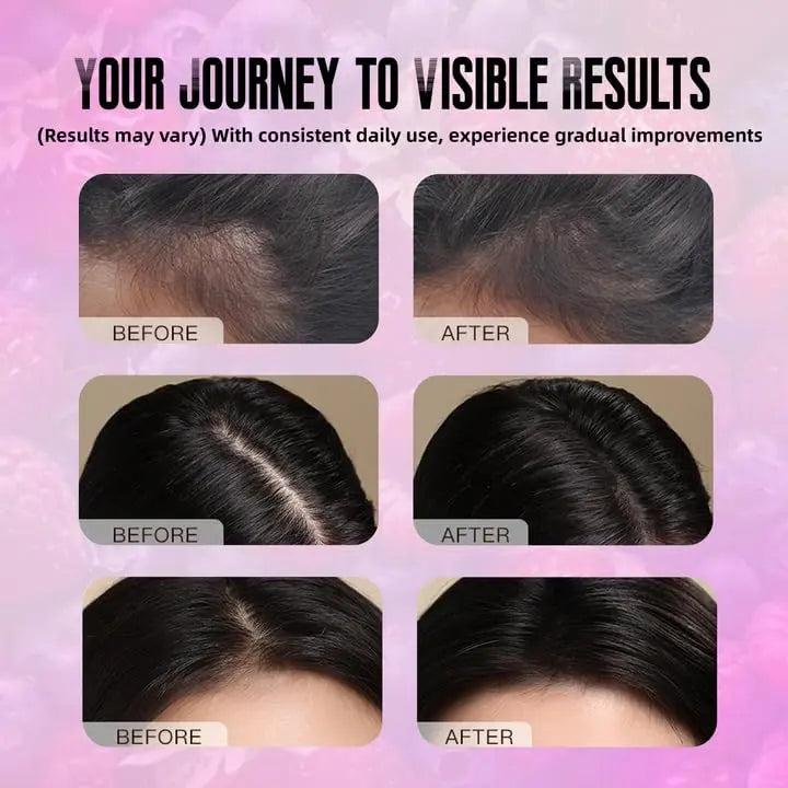 BDQBDQ Lumin Hair Growth Gummies, Infused with Biotin, Vitamins, and Botanical Extracts to Support Healthy Hair Growth and Strength BDQBDQAu supplements