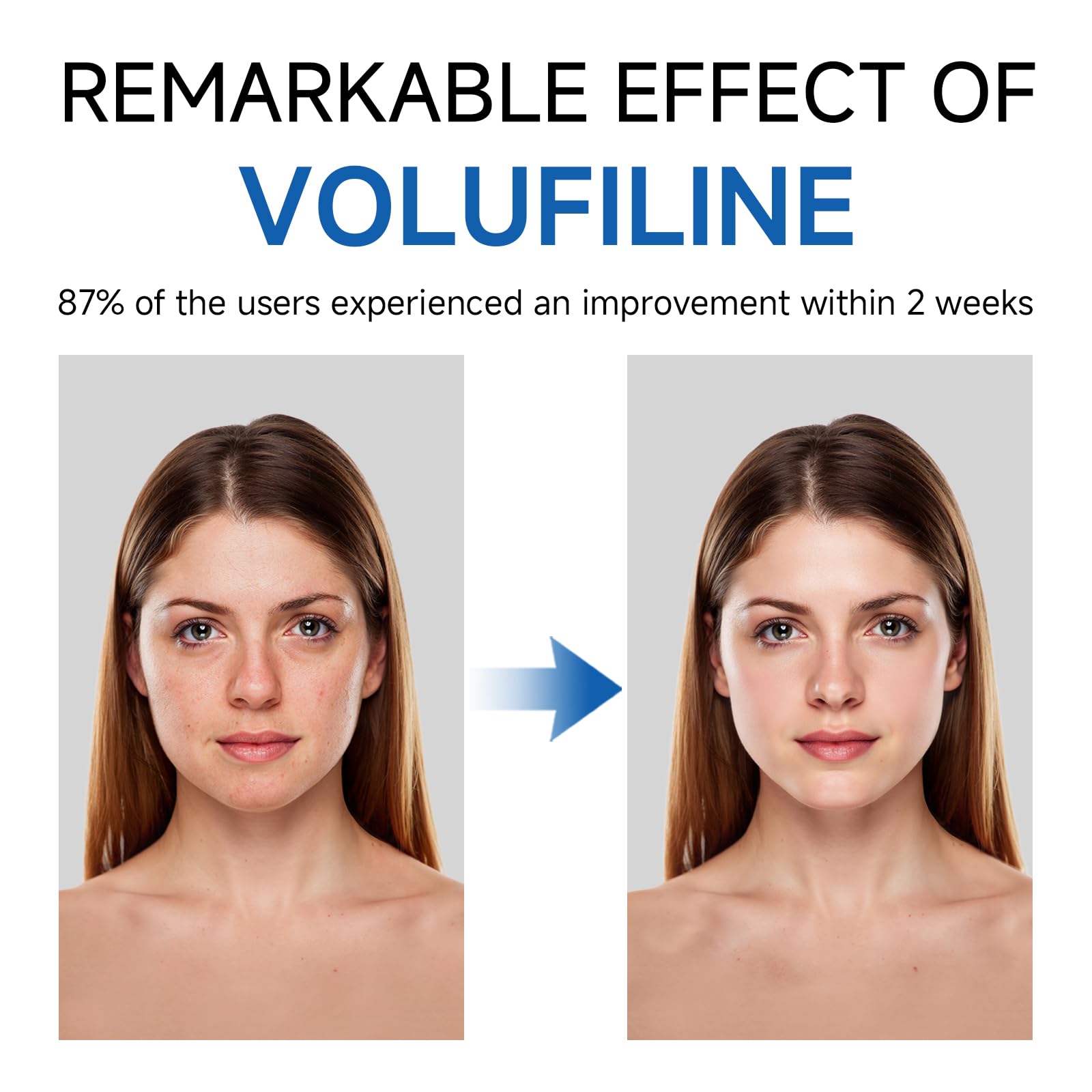 Volufiline Serum, Volufiline Under Eye Serum, Cosmetic Grade Ampoule for Skin Elasticity Improvement, Face & Body Fine Lines, Hydrating Texture, 10ml*2 GUDE GUDEAu supplements