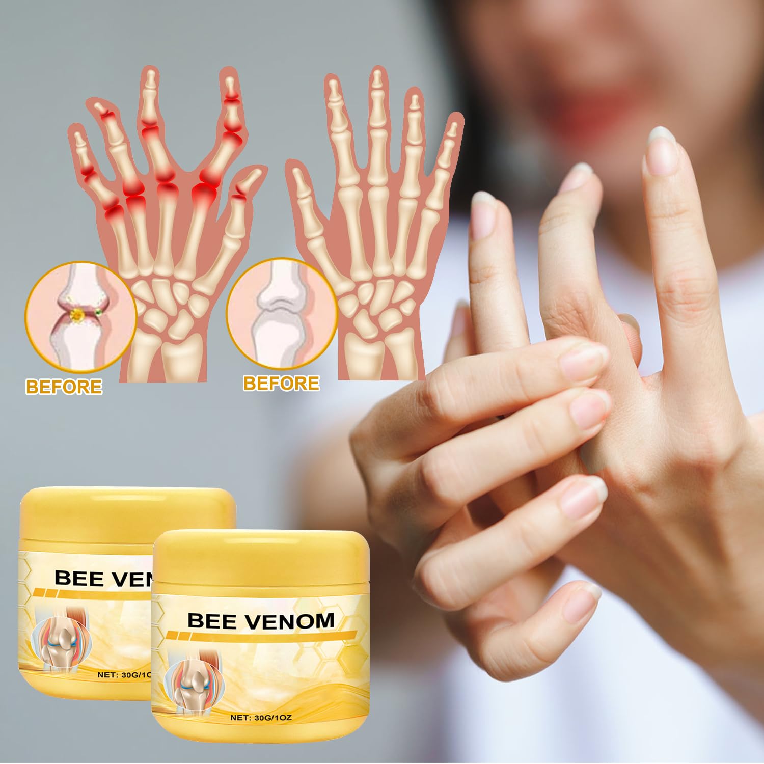 Botou 2PCS New Bee Venom Professional Joint Cream, for Neck, Waist, Back, Hands, Feet and Legs Advanced Bee Propolis Joint Cream, yellow BotouAu supplements