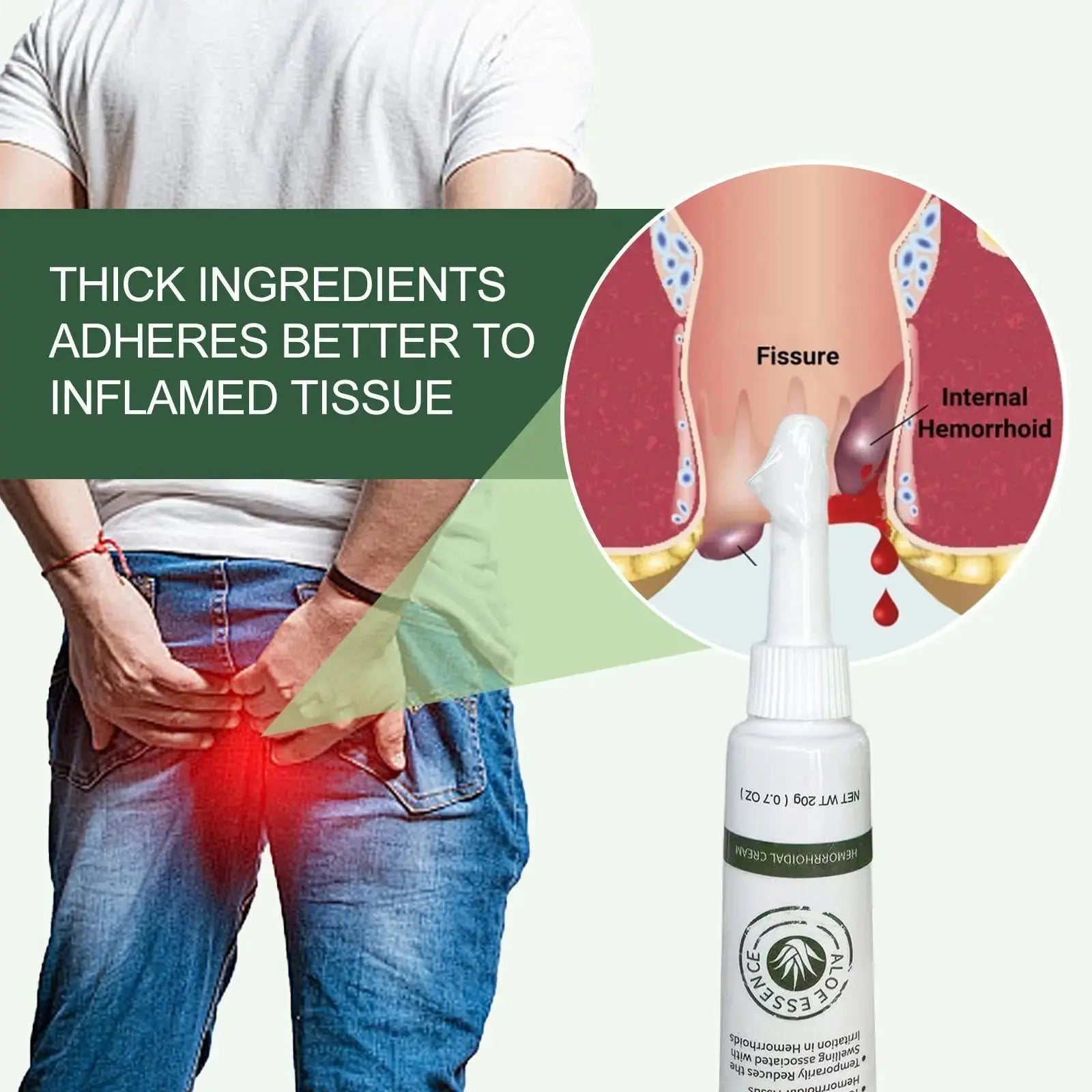 Hemorrhoid & Fissure Ointment, Hemorrhoid Treatment and Hemorrhoid Cream with Lidocaine 4% and Phenylephrine HCI for Fast Relief of Pain, Swelling, Itching, Burning, Hemorrhoidal treatment, 2 Pack-J2 EmisunAu supplements
