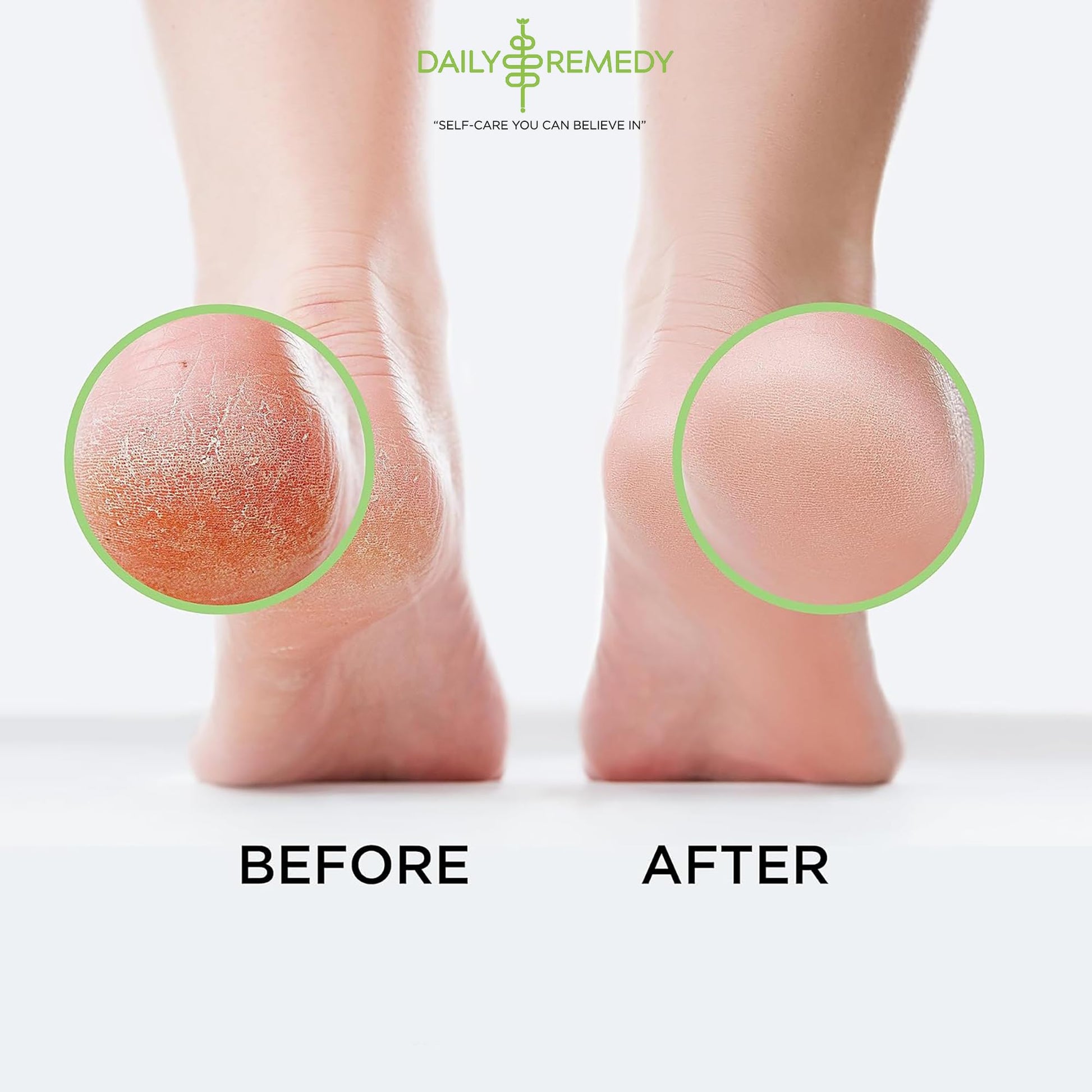Tea Tree Oil Foot Soak with Epsom Salt - Made in USA - for Toenail Athletes Foot DAILY REMEDYUS supplements