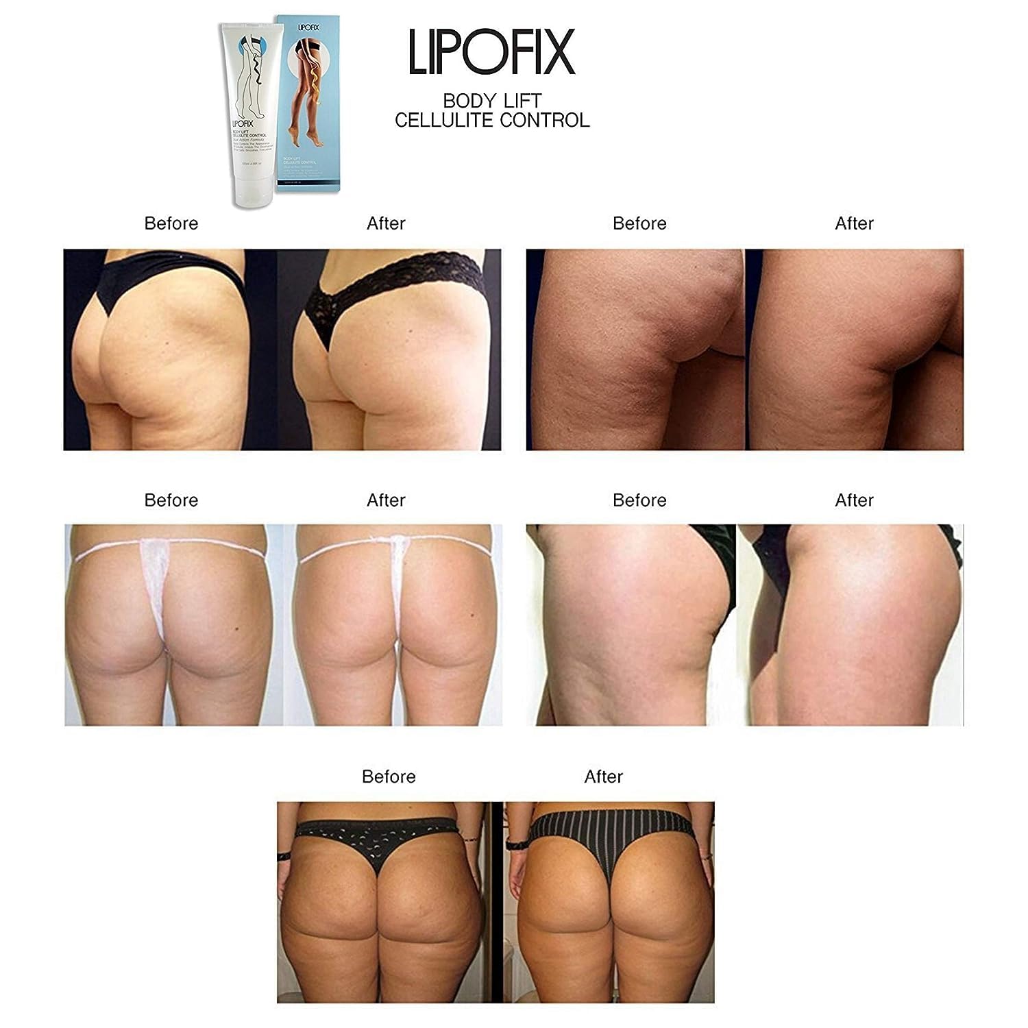 LIPOFIX Anti Cellulite Cream Luxurious Formula Body Contour Cream Effectively Tone LIPOFIXUS supplements