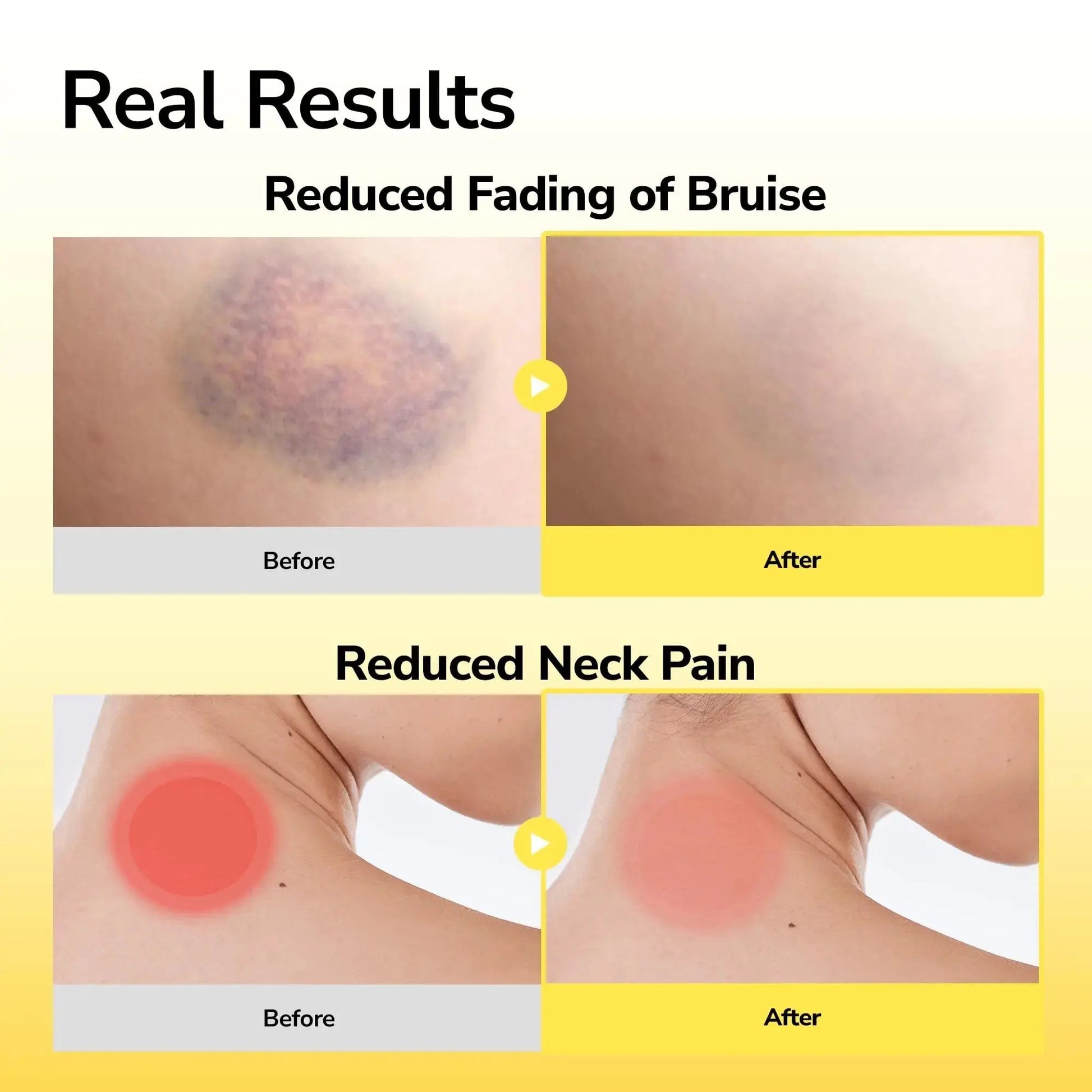 LABOFLEX Arnipatch Natural Arnica Pain Relief Hydrogel Patches – Long Lasting Relief for Muscle Soreness, Swelling, Inflammation, Stiffness & Injury on Back, Knee & Neck (Box, 10, Count) LABOFLEXAu supplements