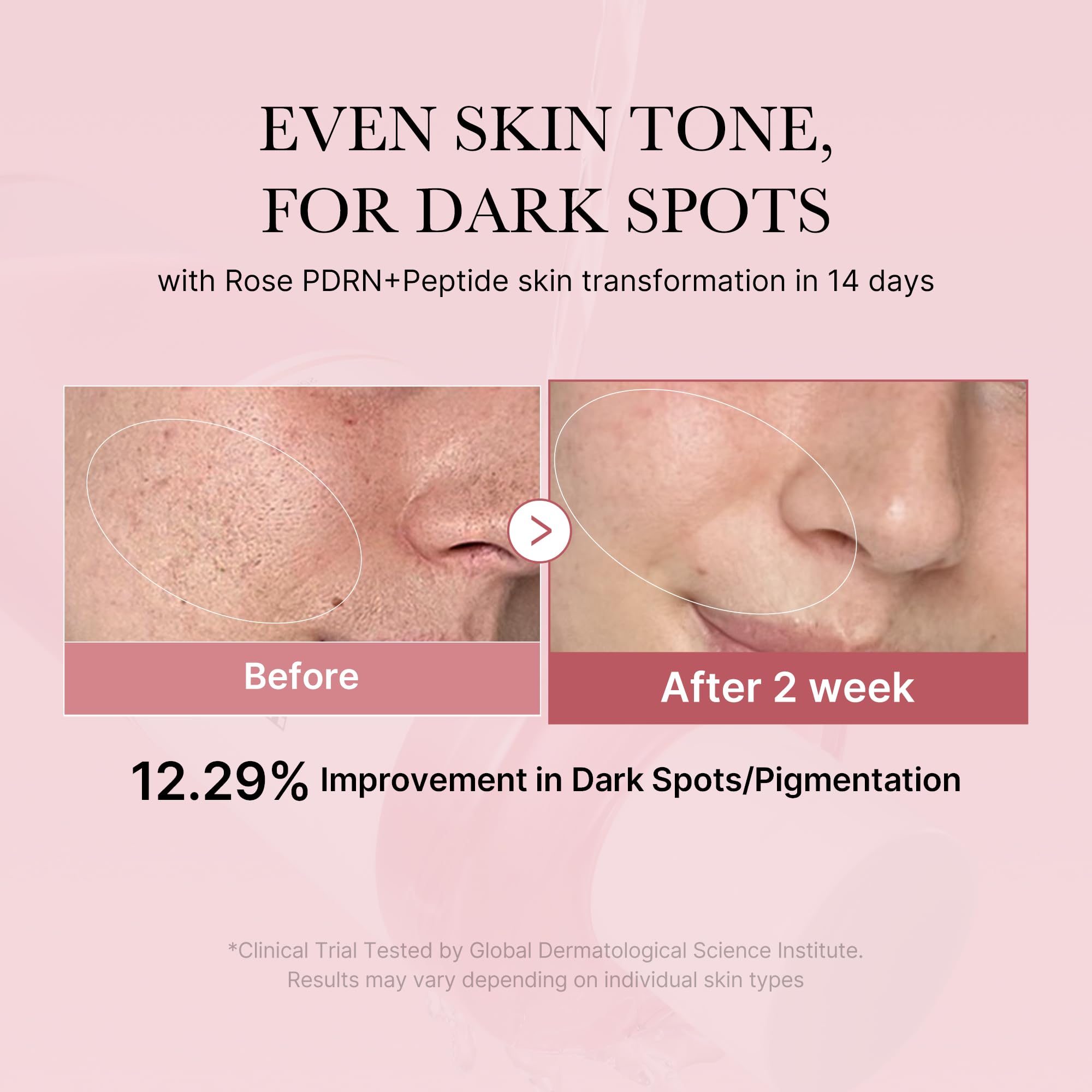 medicube PDRN Toner Rose PDRN Peptide Toner | Lightweight & Watery Type for Skin Boosting, Soothing and Calming, Uneven Skin Tone | with Rose, Peptide, Niacinamide | Korean Skincare, 8.45 fl.oz medicubeAu supplements