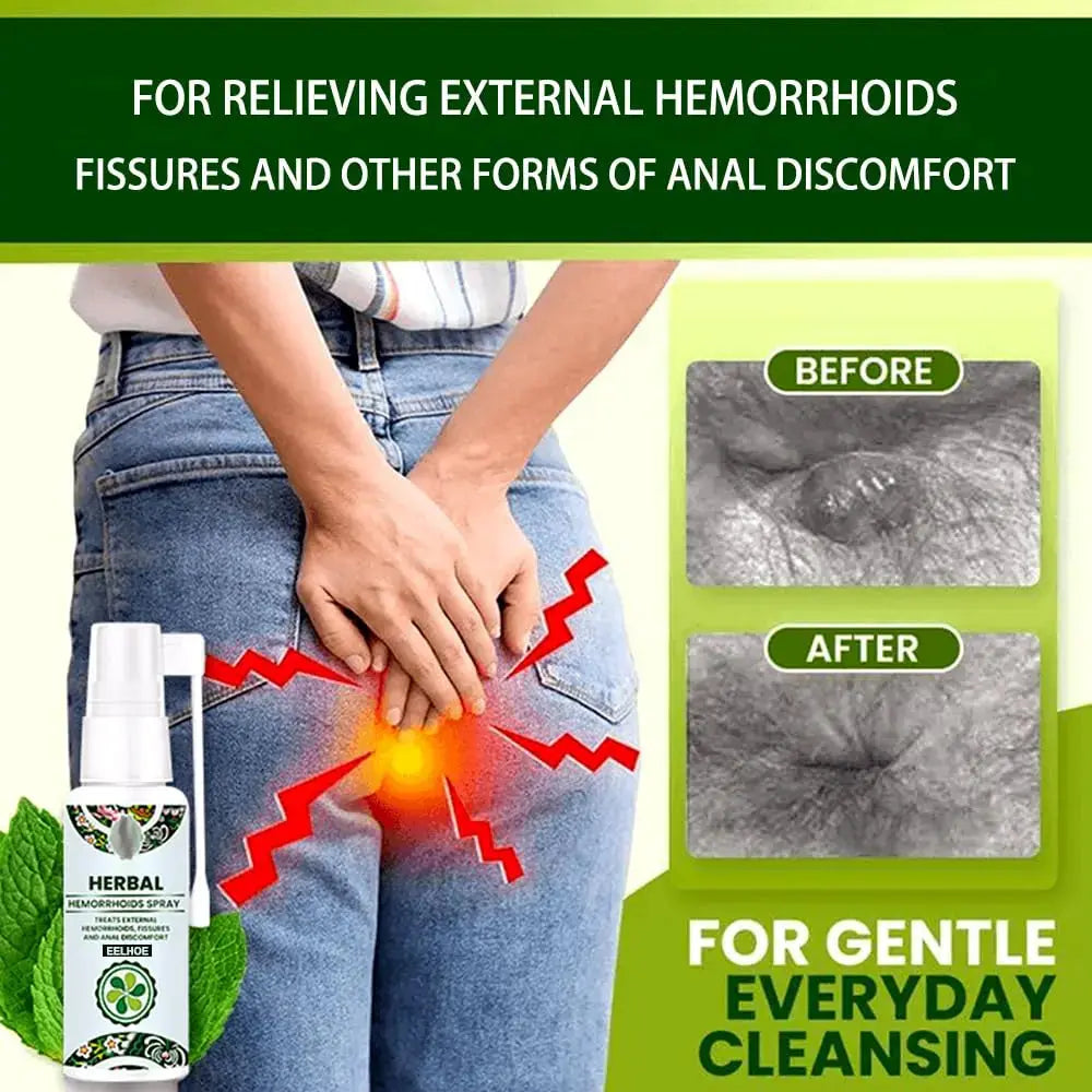 Juztec Hemorrhoid Treatment - Fast Relief with Hemocare Herbal Hemorrhoids Spray & Analese Numb Cream (1 PCS) JuztecAu supplements
