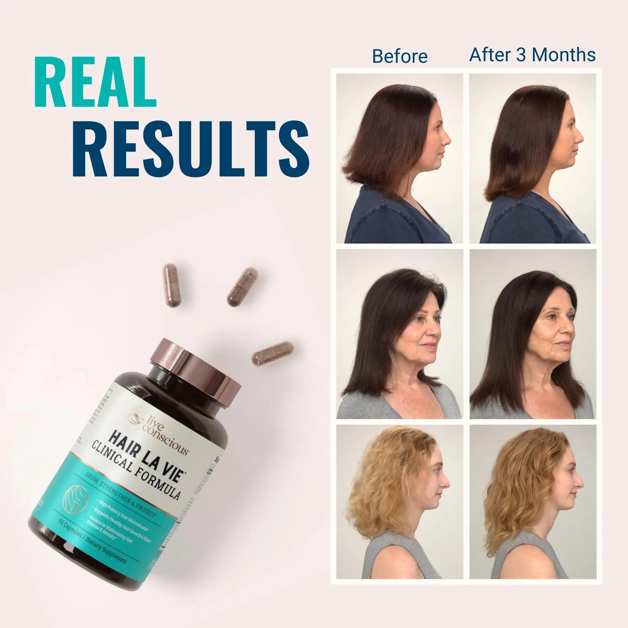 Hair La Vie Live Conscious Clinical Formula Hair Growth Vitamins for Women and Men w/Biotin, Collagen & Saw Palmetto (Pack of 1) Hair La VieAu supplements