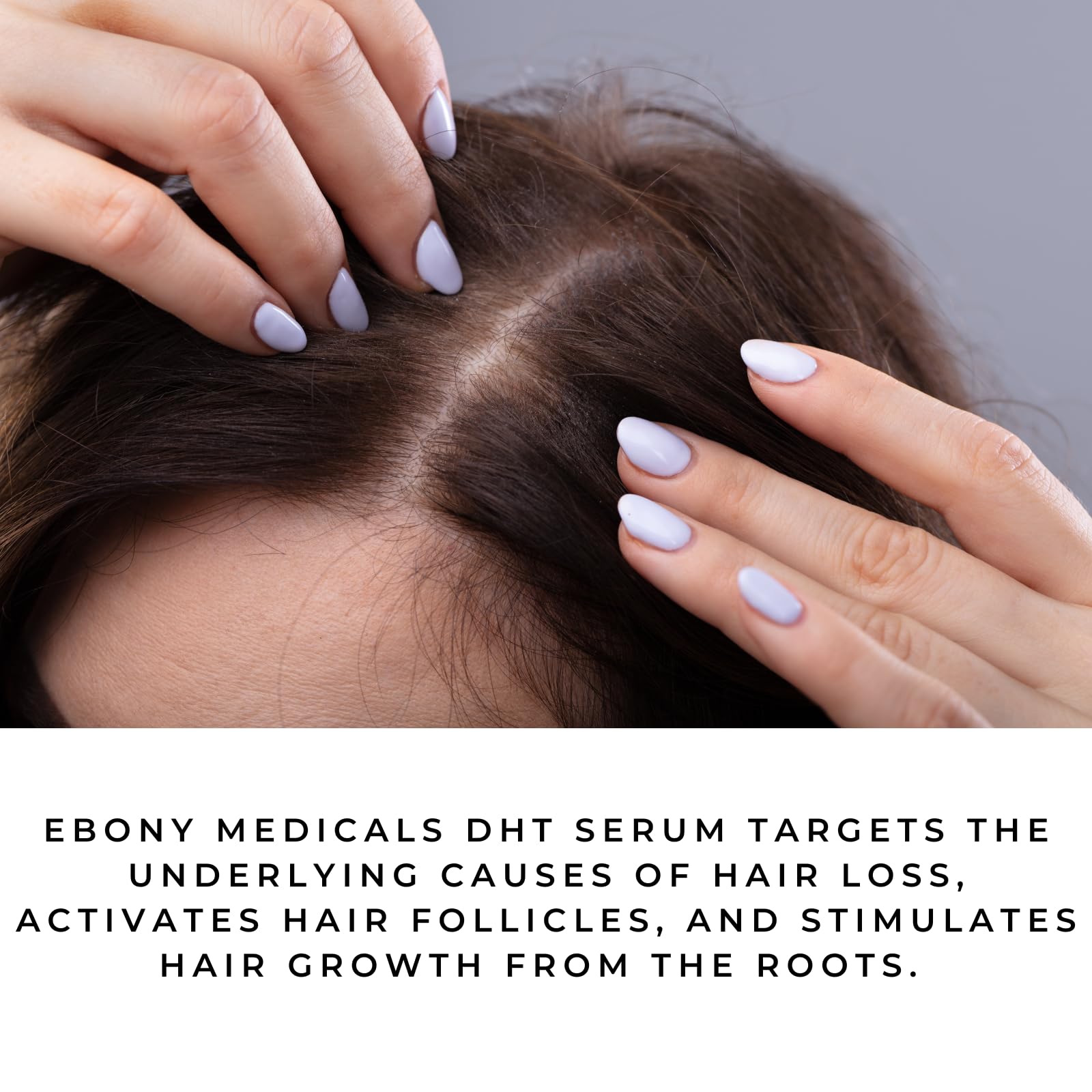 Ebony Medicals DHT Blocker Hair Growth Serum - Hair Loss Supplement, Supports Natural Regrowth Natural CurvesAu supplements
