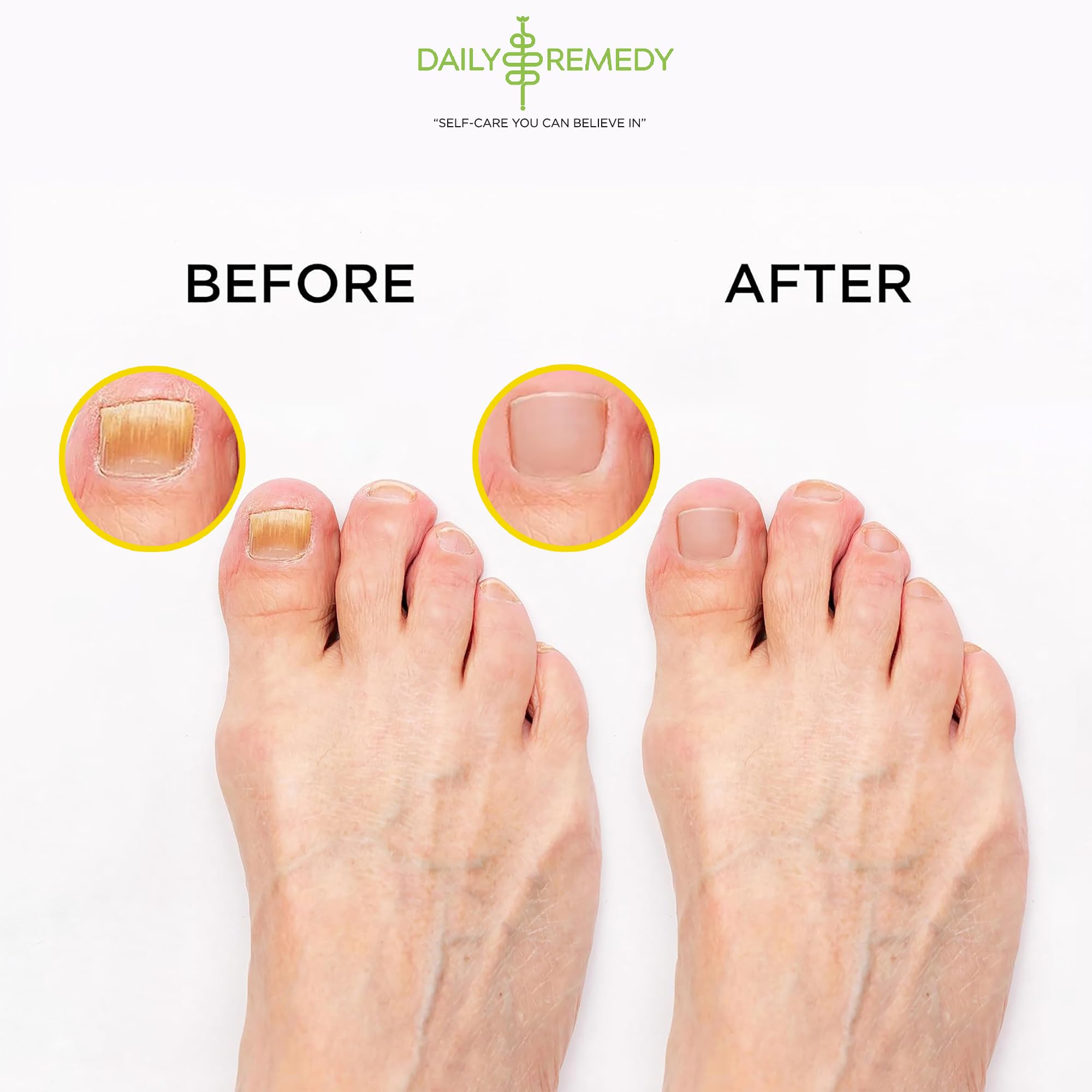 Citrus Detox Foot Soak with Epsom Salt - for Foot Callus, Immune Boost, Damaged Toenail DAILY REMEDYUS supplements