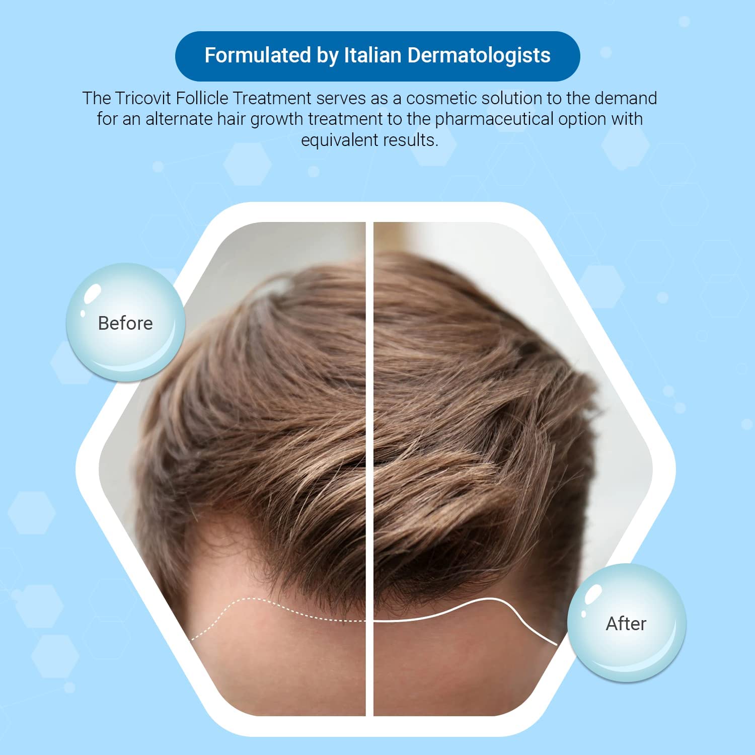 Tricovit Hair Growth Supplement - Nail & Hair Health Vitamins with Amino Acids, Minerals & Antioxidants - Dermatologist-Formulated & Gluten-Free Vitamins and Supplements for Women & Men (60 tablets) TricovitAu supplements
