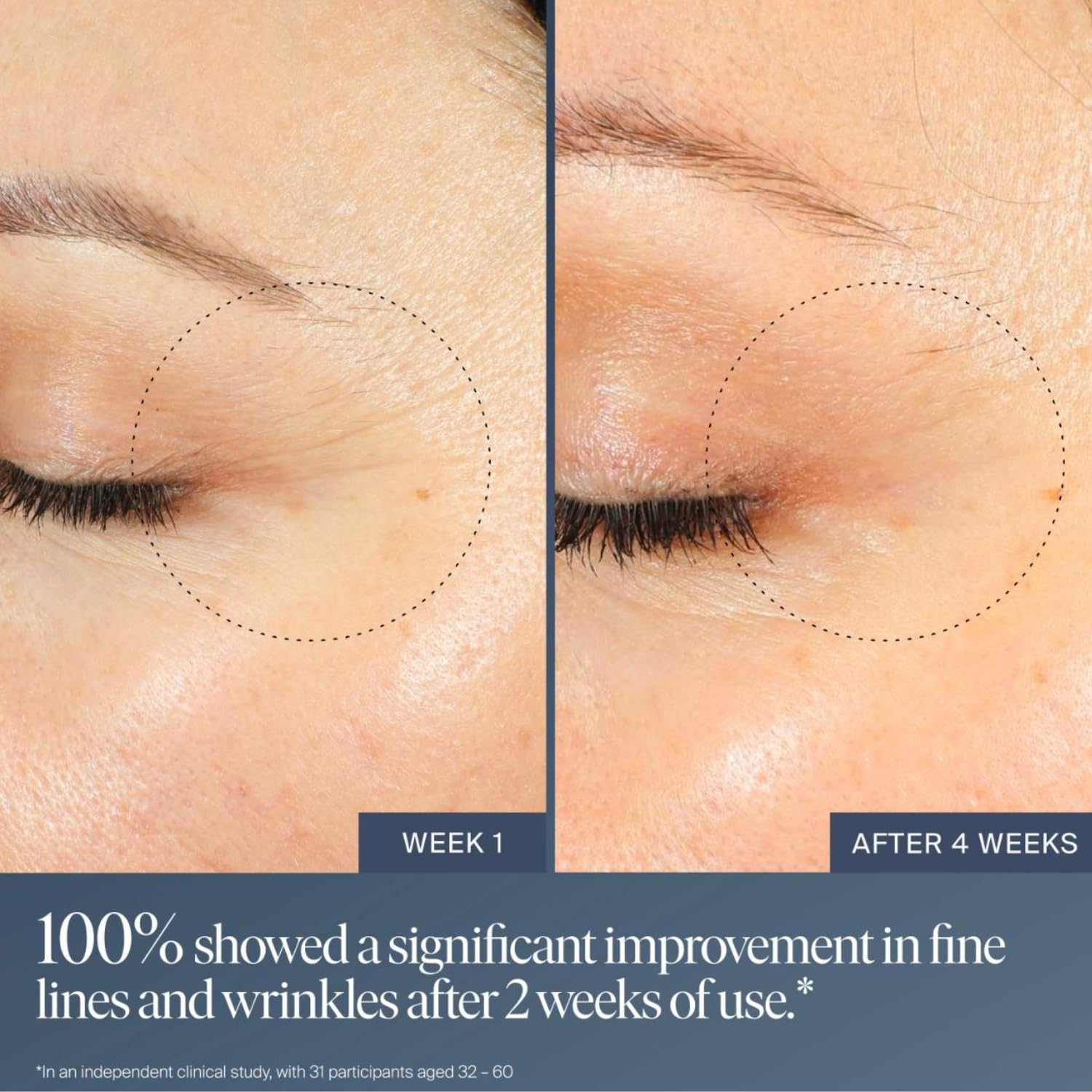 Summer Fridays Jet Lag Overnight Eye Serum - Nourishing Undereye Treatment for Dark Circles - Helps to Hydrate, Smooth, Firm & Depuff - Enriched with Glycerin to Lock in Moisture (0.5 Fl Oz) Summer FridaysAu supplements