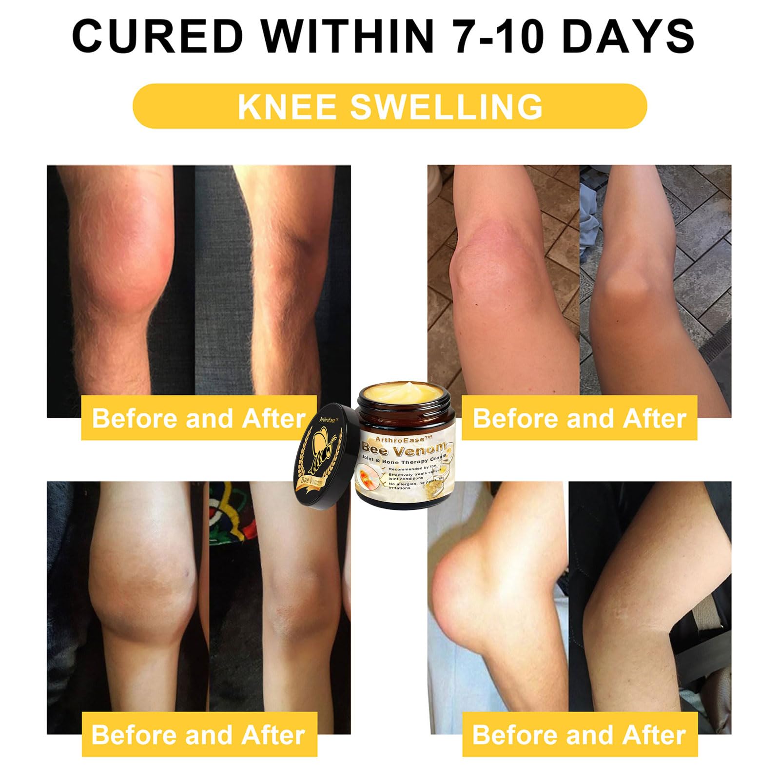 ArthroEase Bee Venom Joint and Bone Cream,ArthroEase Bee Venom Cream,Bee Venom Joint Gel,Effectively Relieve Joint discomfort (2) ADFIREAu supplements