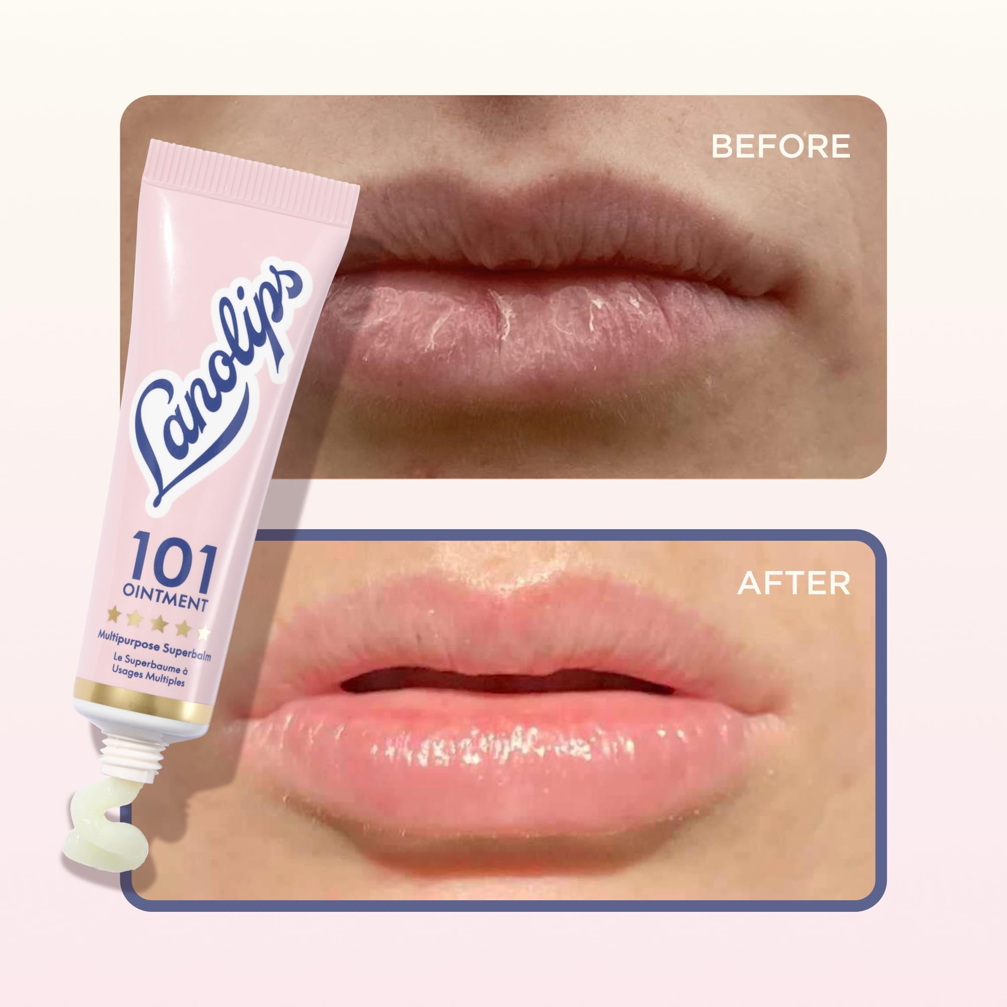 Lanolin 101 Multipurpose Ointment - Lanolin Lip Balm & Healing Ointment for Skin Barrier Repair - Moisturizer for Dry Lips, Cuticles & Elbows - No Petroleum Formula - Original Superbalm (0.52 oz) LanolipsAu supplements