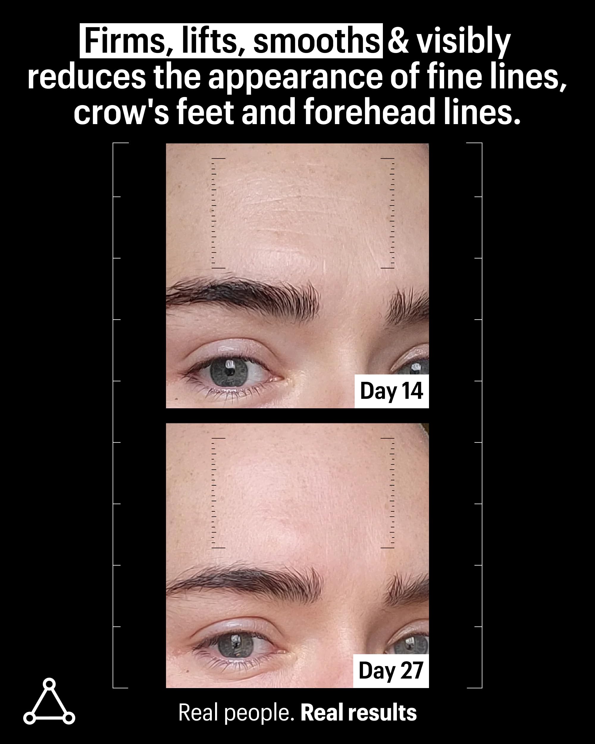 Allies of Skin Multi Peptides & Growth Factor Collagen Boosting Face Serum | Skin Tightening Anti-Aging Complex with 9% Peptides| Firms Sagging Skin & Visibly Reduces Wrinkles (1 oz) Allies of SkinAu supplements