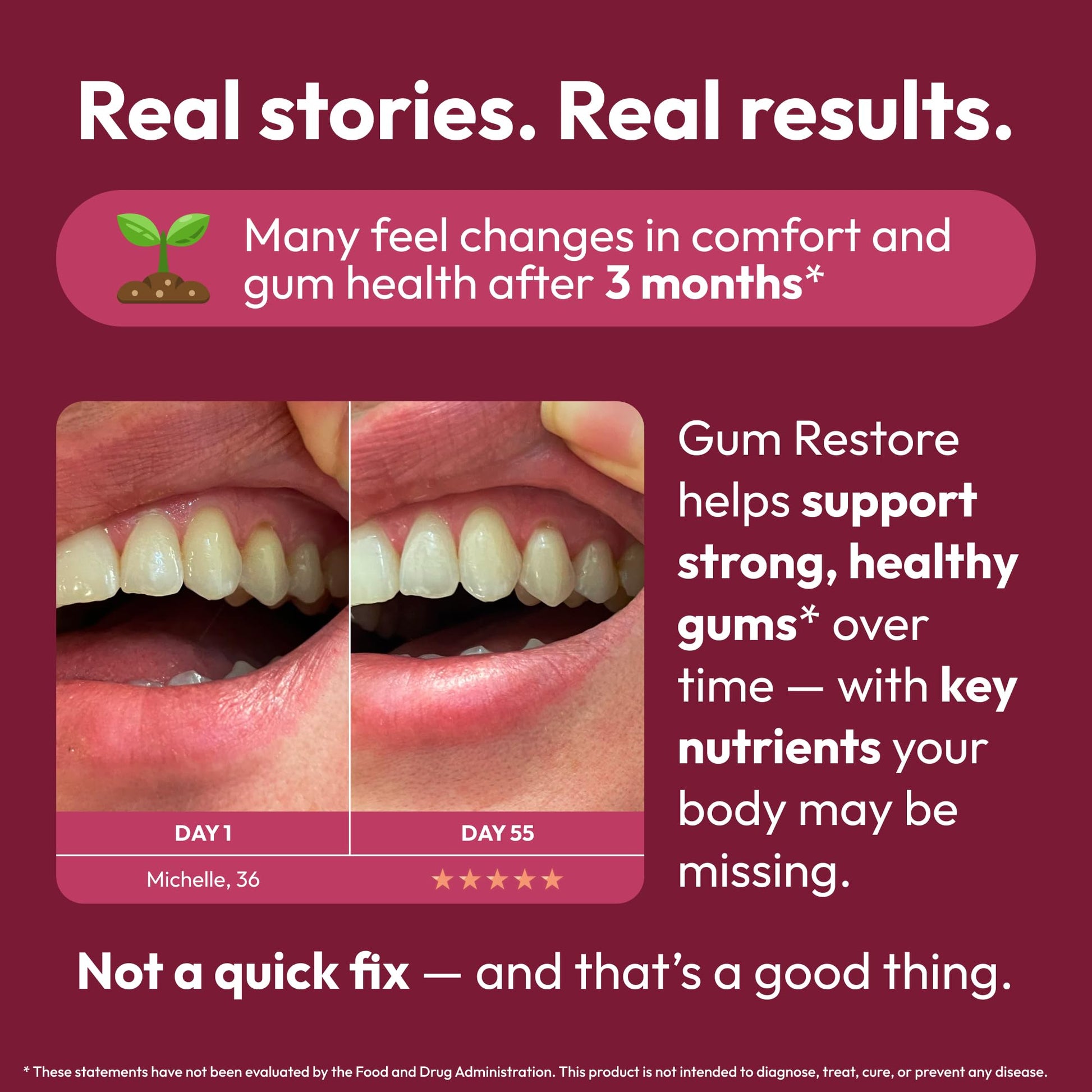 Strong Jaw Gum Restore - Gum Repair for Receding Gums | Teeth Magnesium Supplements, Oral Care, Remineralizing Dental Health Vitamins for Adults | 1 Month Supply, 180 Capsules, Made in USA Strong JawAu supplements