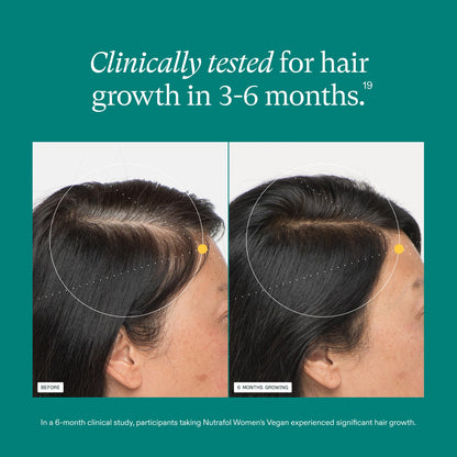 Nutrafol Women's Hair Growth Supplements, For Women 18-44 Years Old, Clinically Tested for Visibly Thicker, Stronger Hair, 100% Vegan Ingredients, NutrafolUS supplements