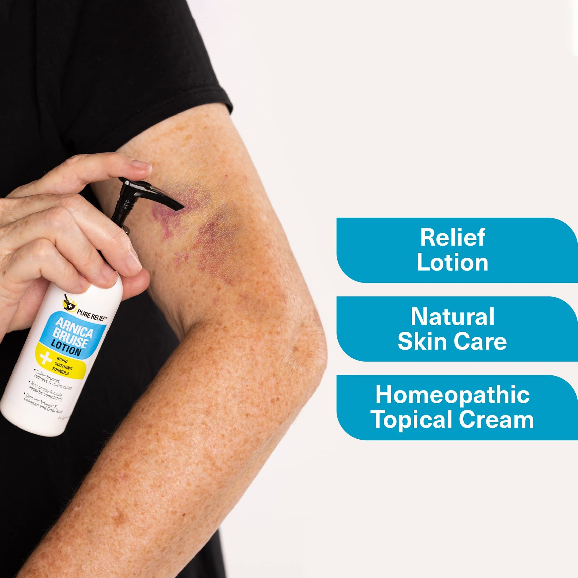 Pure Relief Arnica Bruise Relief Lotion for Bruising, Swelling, & Discoloration On Skin, Natural Skin Care Arnica Bruise Homeopathic Topical Bruise Cream W/Aloe Vera & Collagen, 4 Fl Oz (Pack of 3) Pure ReliefAu supplements