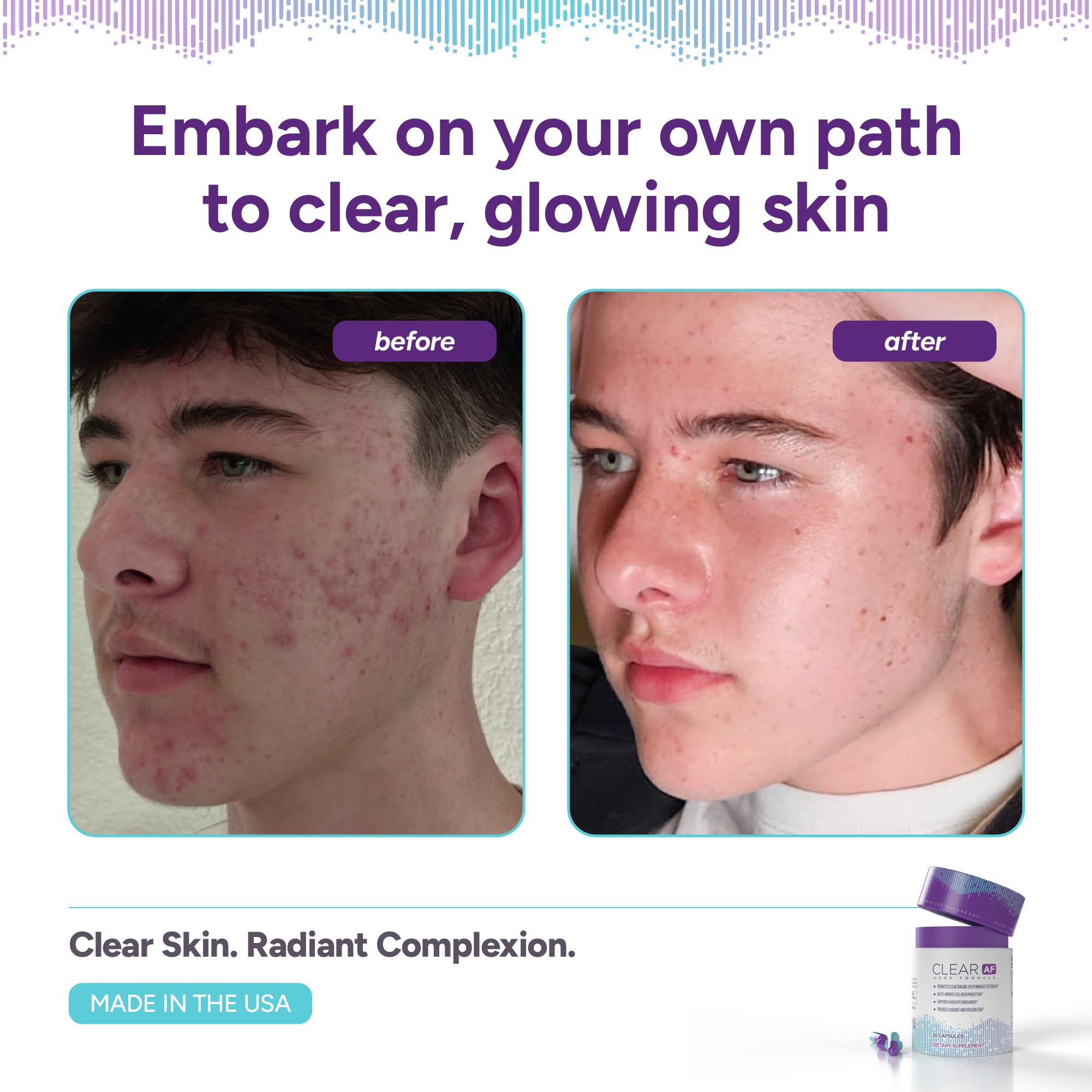 Clear AF Clear Skin Supplement | Skin Barrier Hydration & Clear Complexion Support with Vegan Ceramides, Zinc, Vitamin D3, B6, Riboflavin & Thiamine | Vegan Capsules | 30-Day Supply Clear AFAu supplements