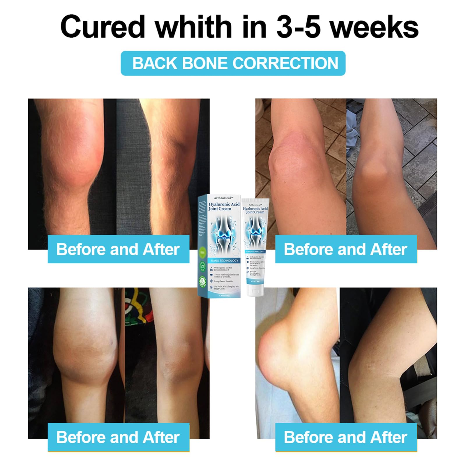Luhaka ArthroHeal Hyaluronic Acid Joint R-epair Cream,ArthroHeal Joint Cream,Quickly relieve joint discomfort, Quickly relieve joint discomfort, suitable for joint activities throughout the body (1) LuhakaAu supplements