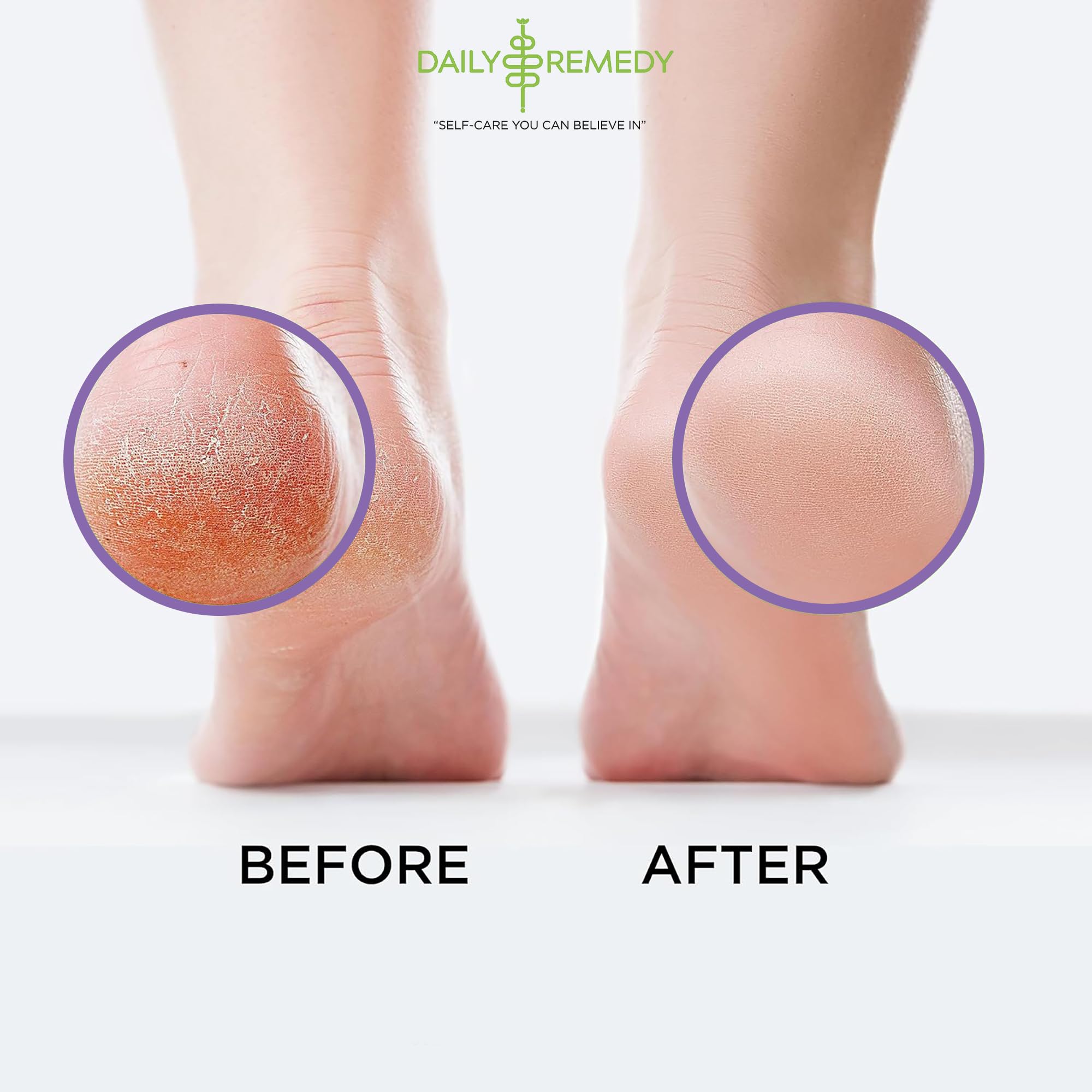 Calming Lavender Foot Soak with Epsom Salt, Made in USA, Foot Soak Soothes Sore Tired DAILY REMEDYUS supplements