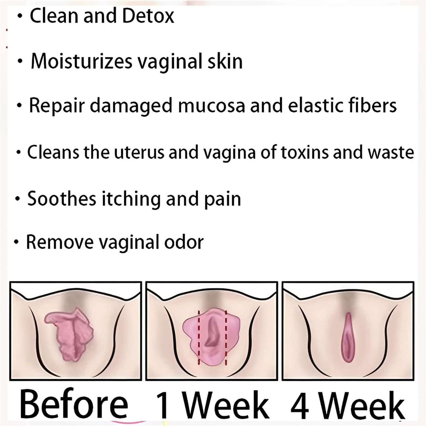 AnnieCare Instant Anti-Itch Detox Slimming Products, Annie Care Natural Detox Viginal Gel DASHENRANUS supplements
