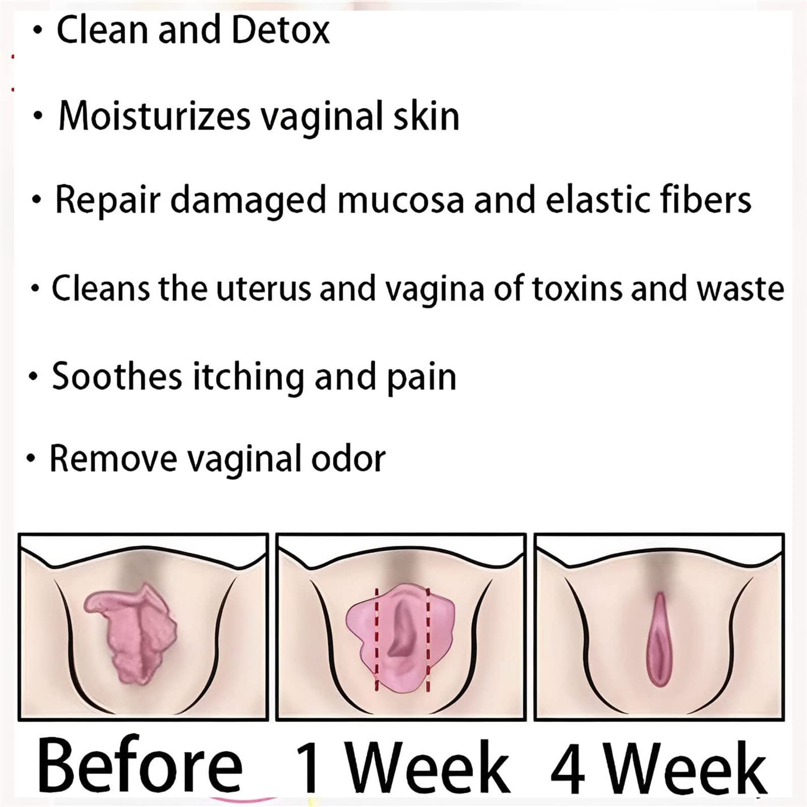 AnnieCare Instant Anti-Itch Detox Slimming Products, Annie Care Natural Detox Viginal Gel DASHENRANAu supplements
