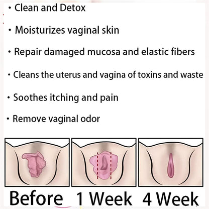 AnnieCare Instant Anti-Itch Detox Slimming Products, Annie Care Natural Detox Viginal Gel DASHENRANUS supplements