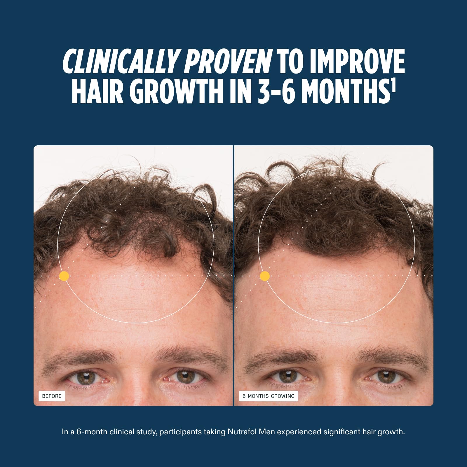 Nutrafol Men's Hair Growth Supplements, Clinically Tested for Visibly Thicker Hair and Scalp Coverage, Dermatologist Recommended - 1 Month Supply NutrafolUS supplements