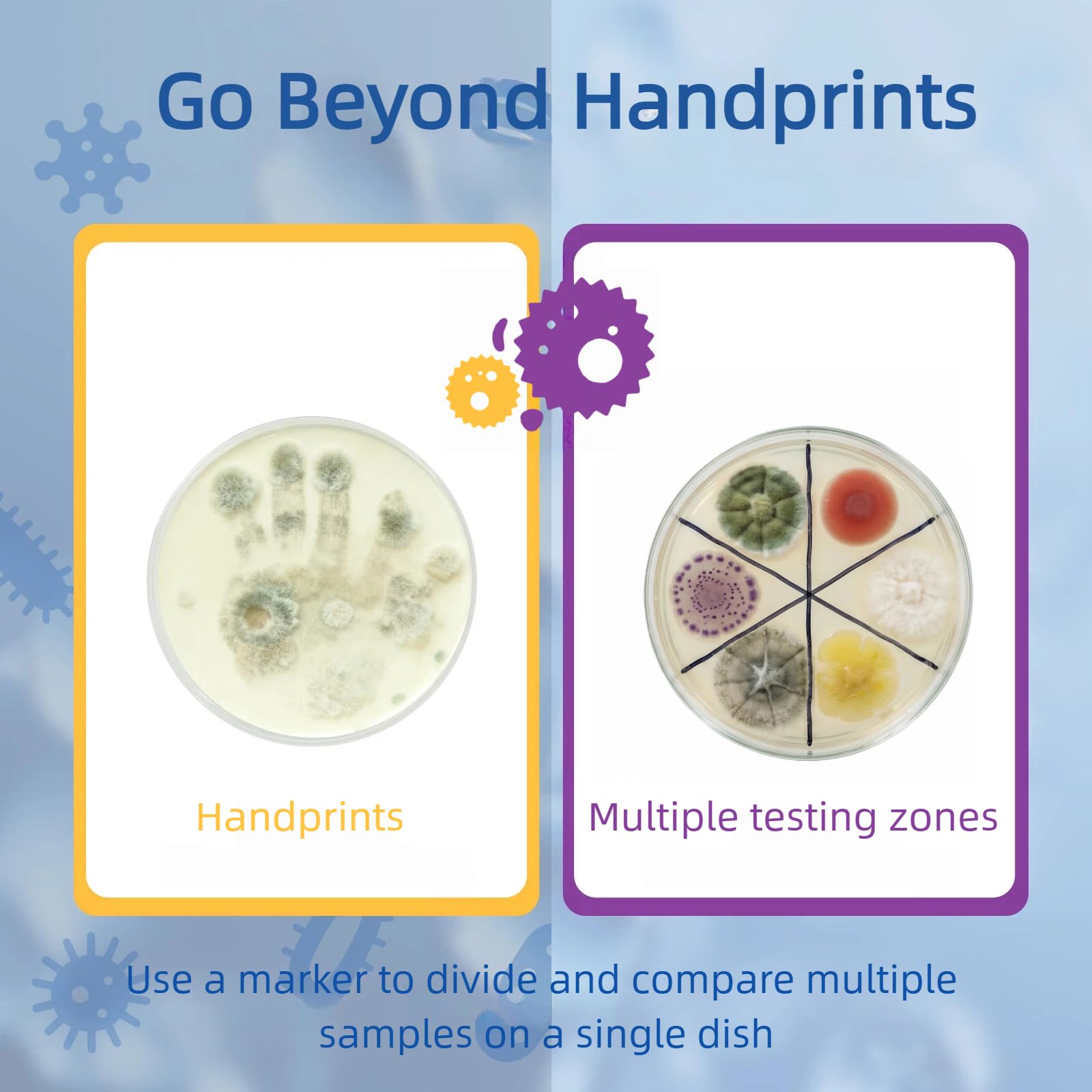 Giant Microbiology Bacteria Science Kit for Kids:2 XL 150mm Prepoured Nutrient Agar Plates, Petri Dishes with Agar & Colony Characteristics Poster for School Projects & Educational Gifts MosynexAu supplements