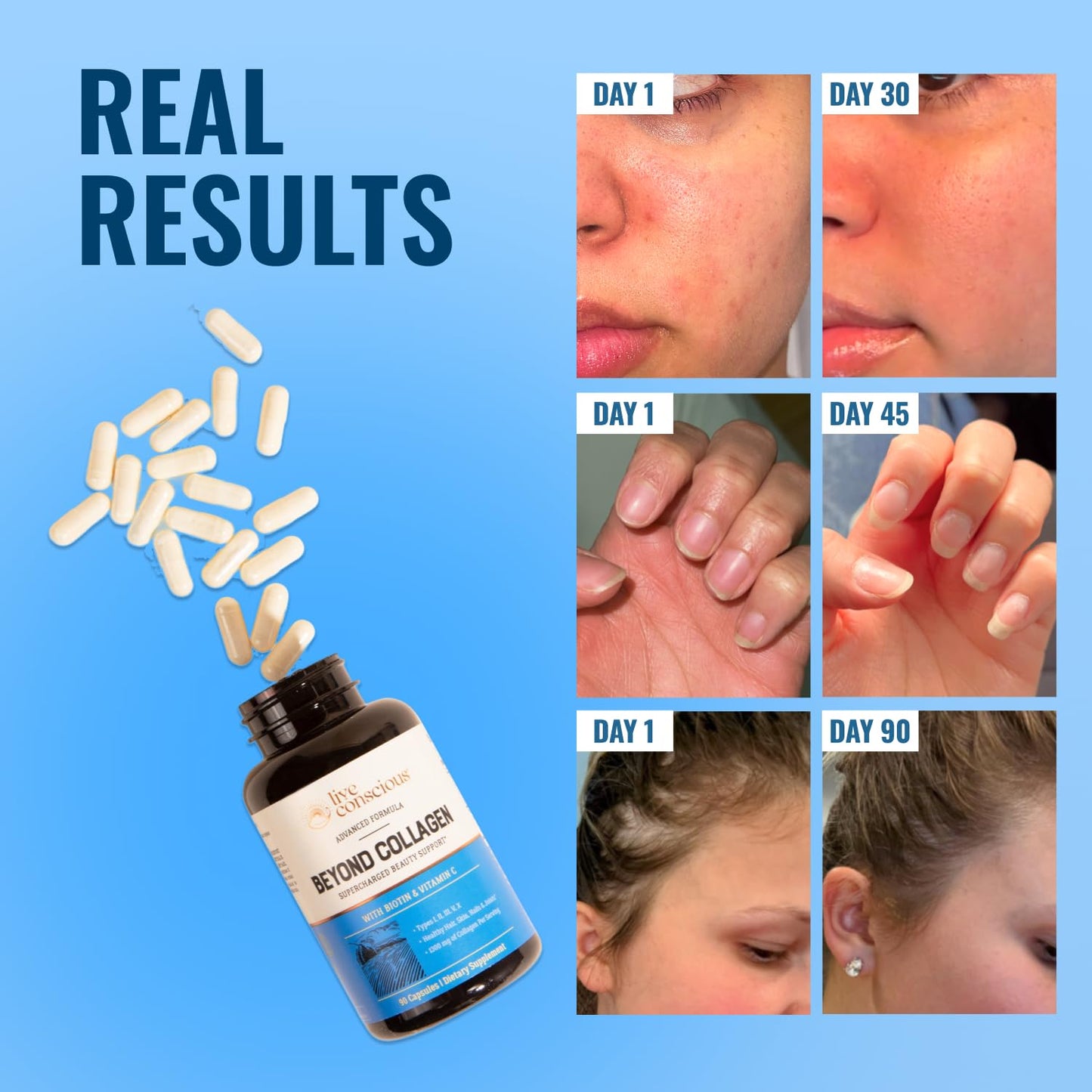 Live Conscious Beyond Collagen Multi Collagen Capsules - Types I, II, III, V & X - Hydrolyzed Blend with Biotin & Vitamin C Live ConsciousUS supplements