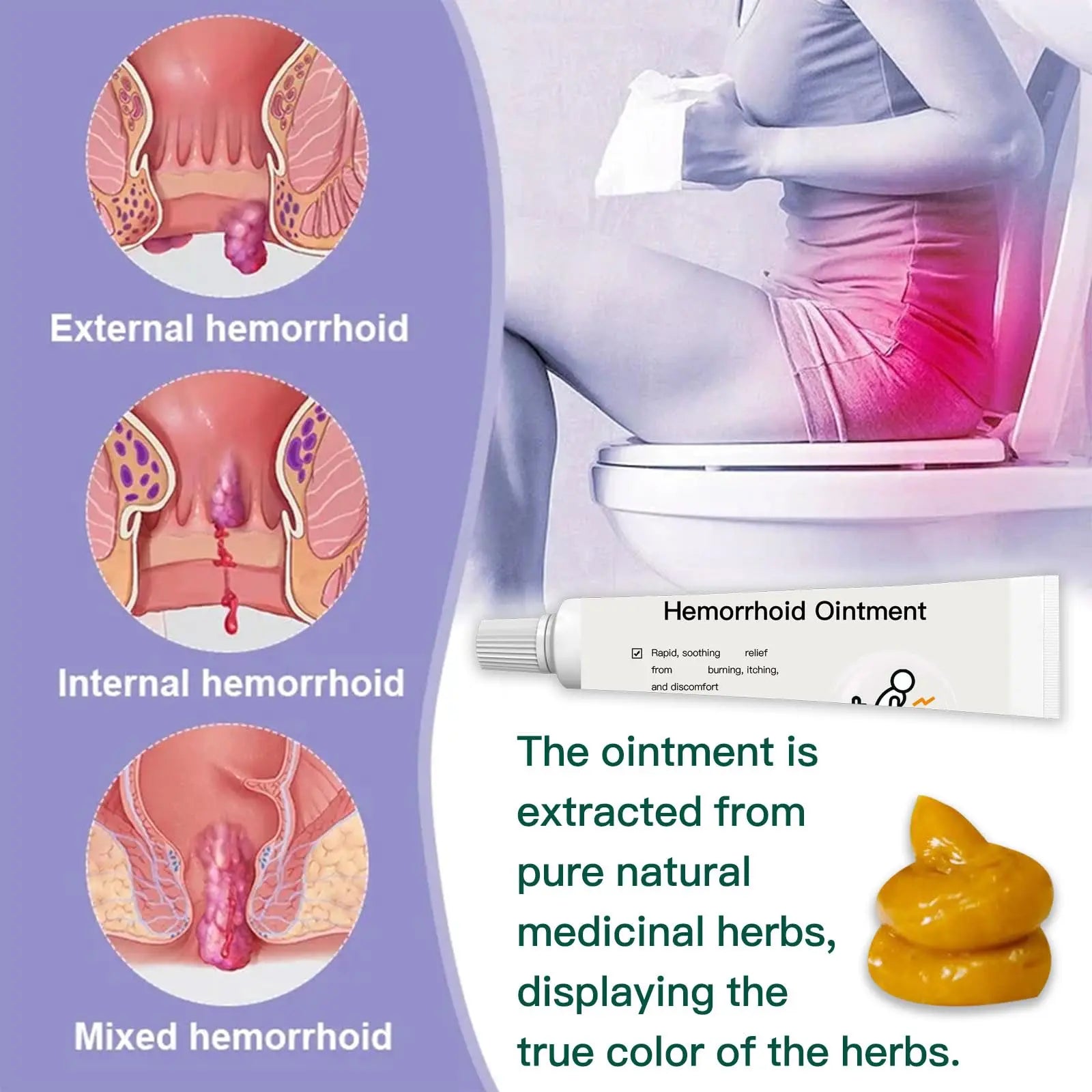 BXQJRJ Hemorrhoid Ointment,Herbal hemorrhoid Gel,Effectively relieves Anal discomfort,Suitable for Men and Women,Fast-Acting hemorrhoid Ointment (20g) BXQJRJAu supplements