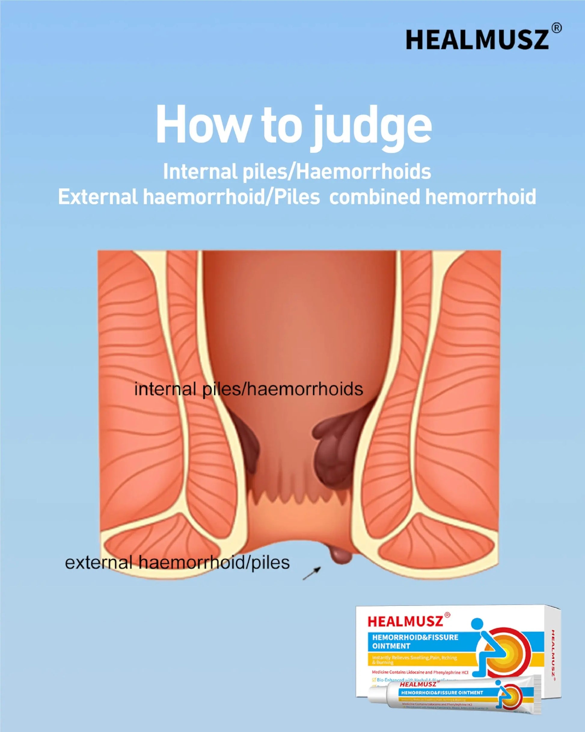 HEALMUSZ Hemorrhoid Fissure Ointment– Hemorrhoid Treatment and Hemorrhoid Cream with Lidocaine and Phenylephrine HCI for Fast Acting Relief of Pain, Swelling, Discomfort, and Itching(1.5 oz) HEALMUSZAu supplements