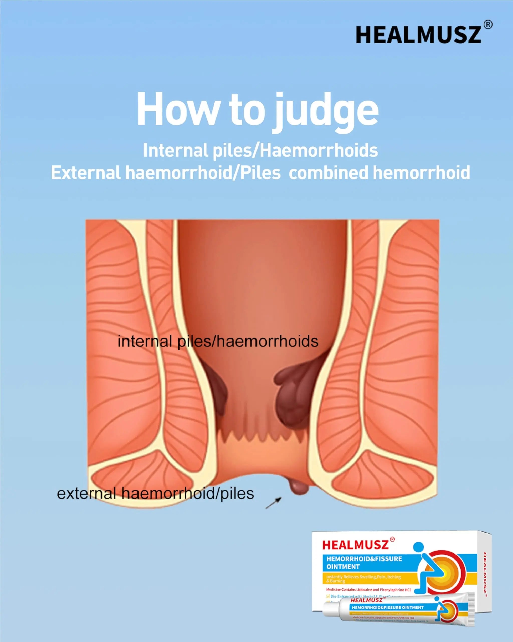 HEALMUSZ Hemorrhoid Fissure Ointment– Hemorrhoid Treatment and Hemorrhoid Cream with Lidocaine and Phenylephrine HCI for Fast Acting Relief of Pain, Swelling, Discomfort, and Itching(1.5 oz) HEALMUSZAu supplements