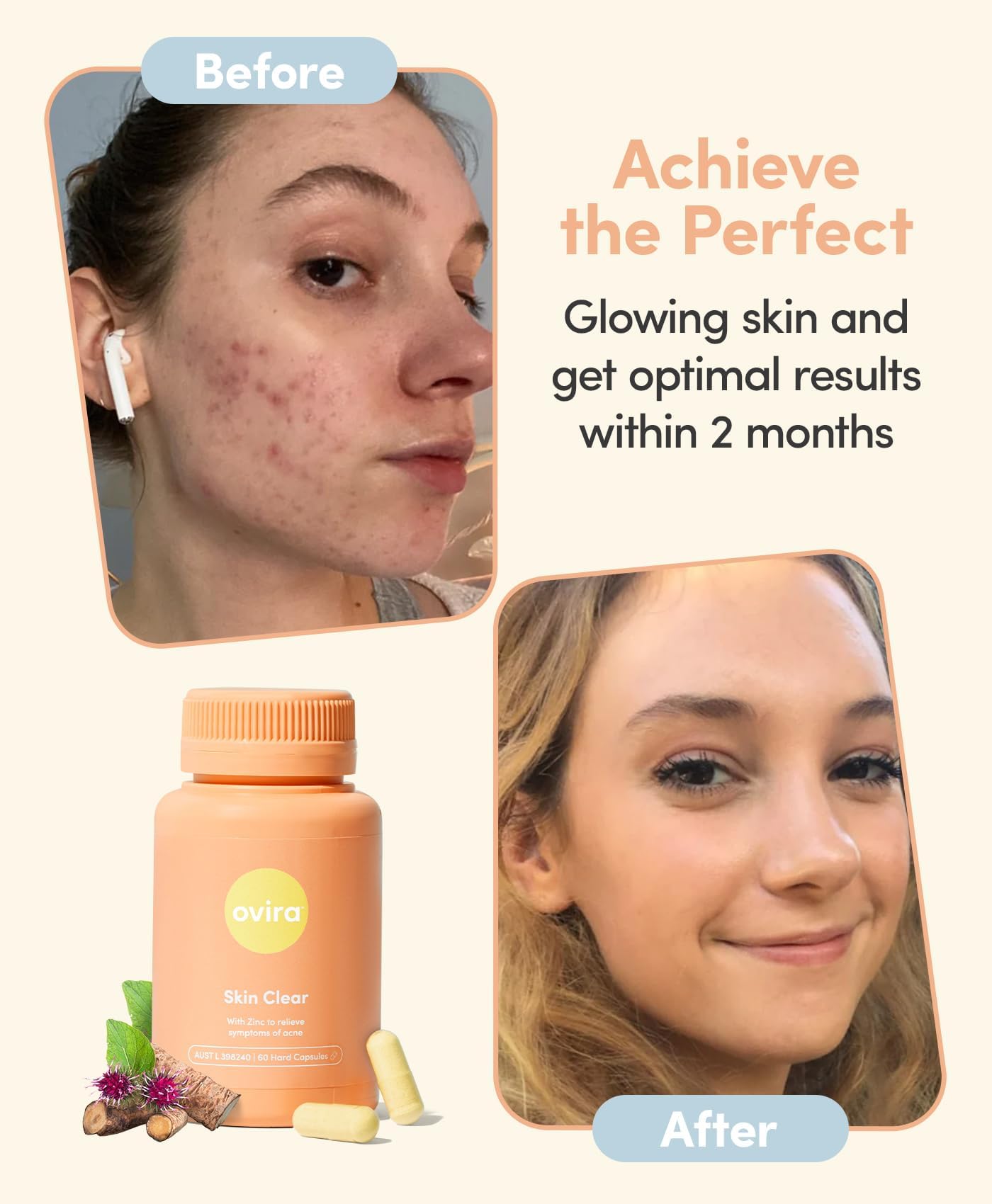 Ovira Skin Clear with ZINCBRIGHT - 60 Capsules for Clear and Glowing Skin | Rosacea & Hormonal Acne Treatment | Support Collagen Production | Acne Supplements for Women & Men - Pack of 2 OviraAu supplements