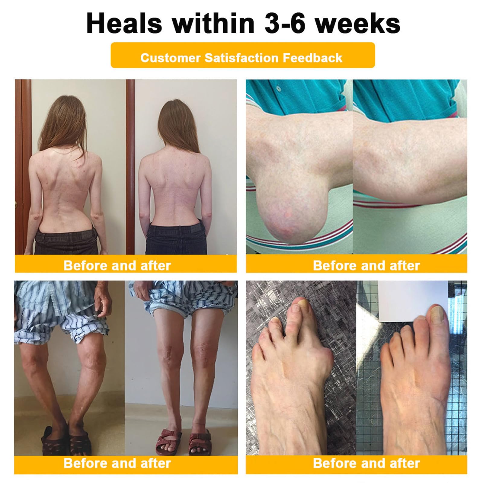 Luhaka Botulinum Toxin & Bee Venom Pain-Relief Bone Healing Cream,Bee Venom Cream,Effectively improve joint mobility (1PC) LuhakaAu supplements