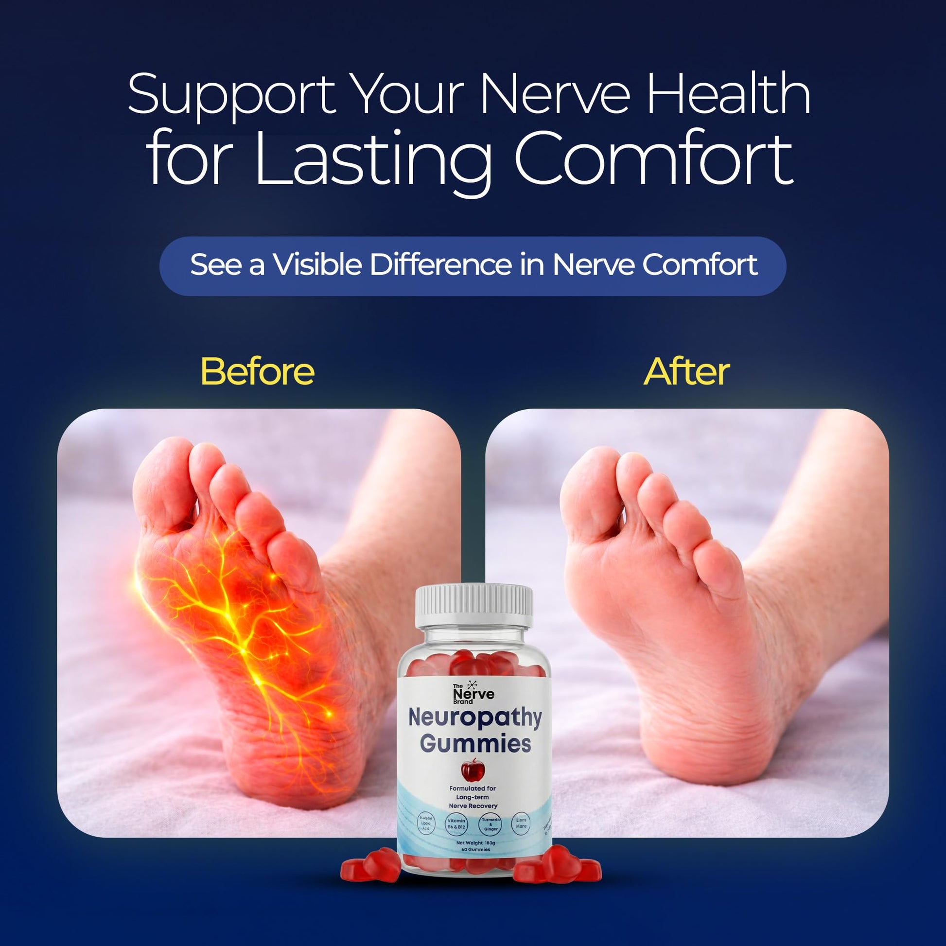 The Nerve Brand Neuropathy Support Gummies, 600 mg R Alpha Lipoic Acid Gummies with B1 B6 B12 and Lion’s Mane, Sugar Free Daily Nerve Health Supplement, 30 Day Supply The Nerve BrandAu supplements