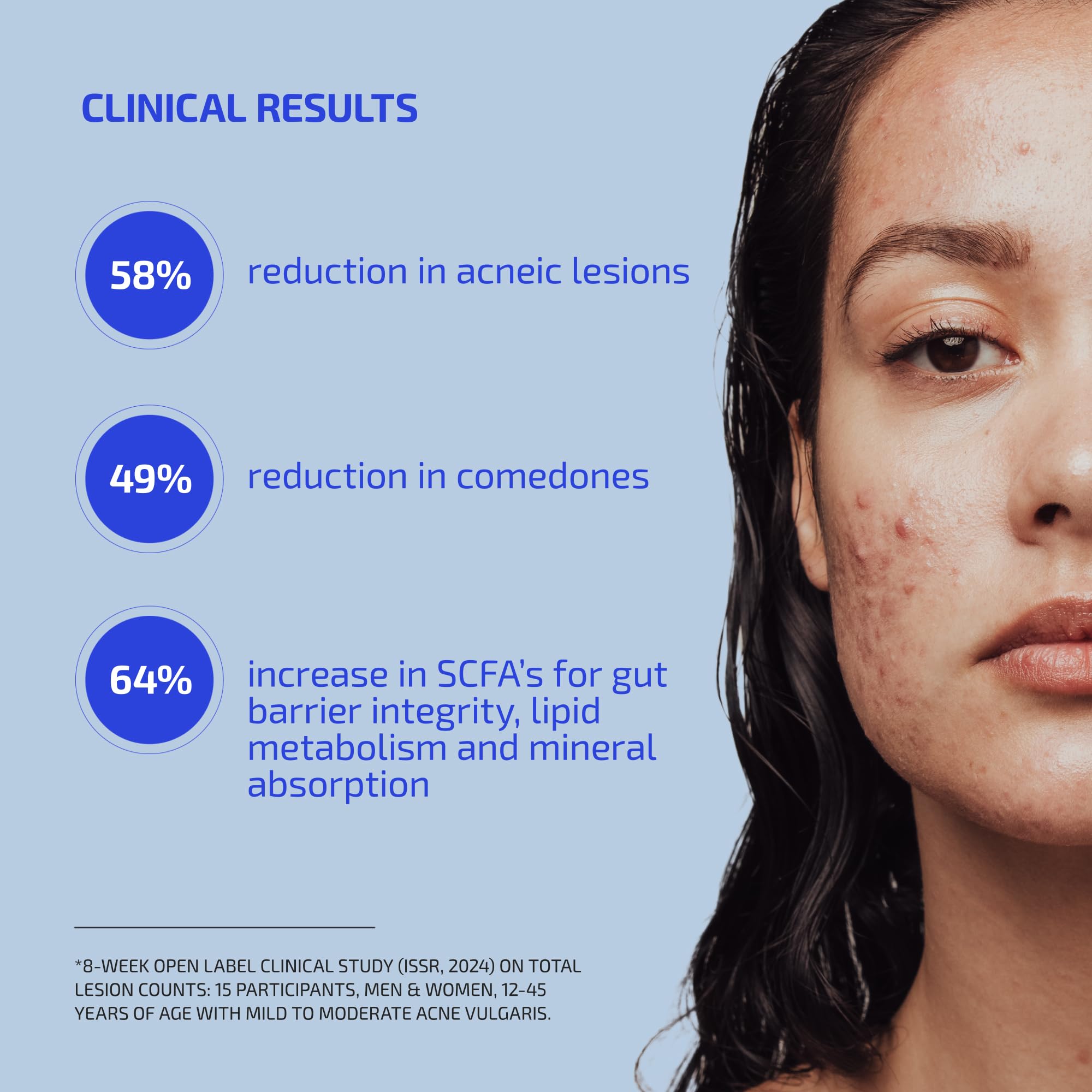 Codex Labs Shaant Clear Skin Supplement – 60 Vegan Capsules | Acne Probiotics with 9-Strain Blend, Green Tea EGCG & Guggul – Daily Support for Acne-Prone Skin & Clear Complexion Codex LabsAu supplements