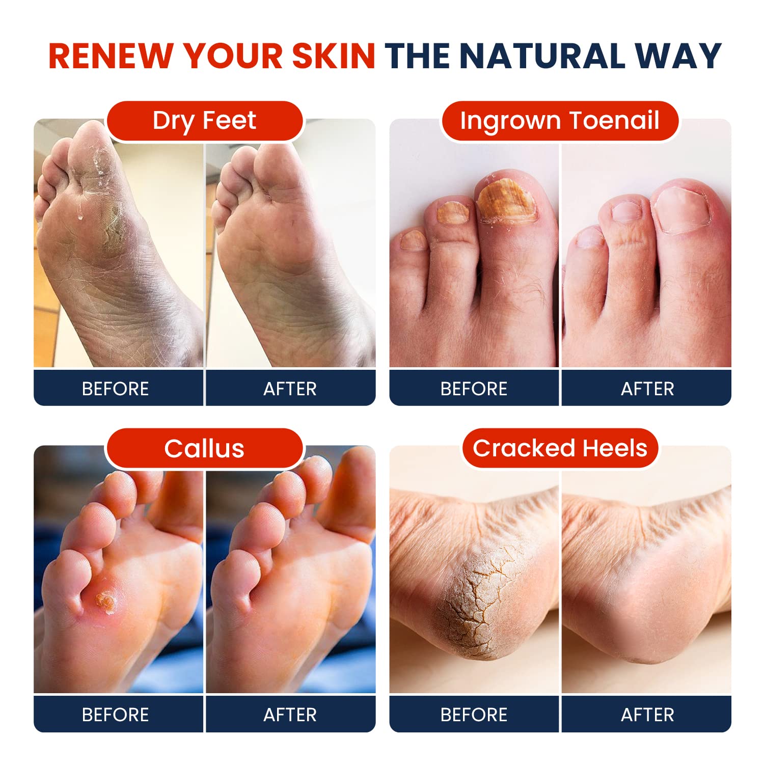 Muscle Relief Foot Soak with Epsom Salts - All Natural Salts for Post Workout Recovery FOOT CUREUS supplements