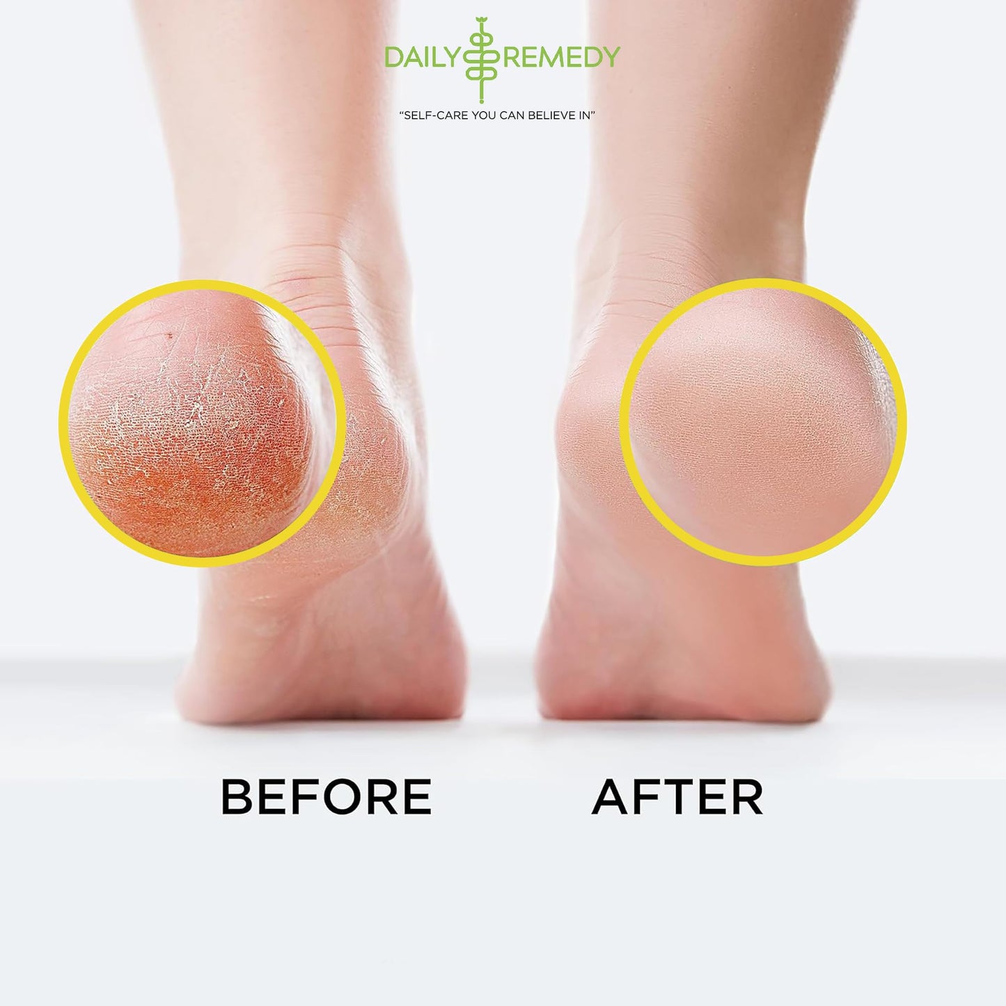 Citrus Detox Foot Soak with Epsom Salt - for Foot Callus, Immune Boost, Damaged Toenail DAILY REMEDYUS supplements